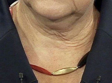 merkel1459