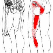 Gluteus%20Minimus
