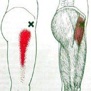 M_Tensor_FL_triggerpoint