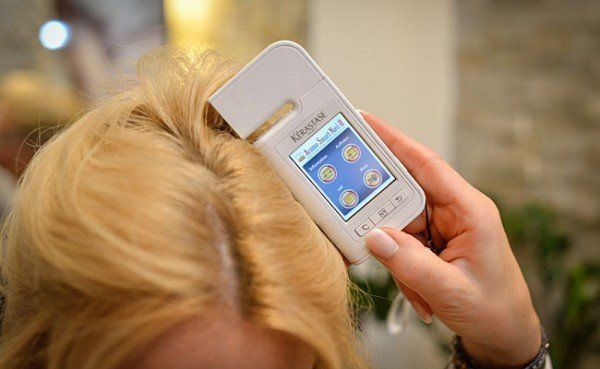 Haare und Kopfhaut unter der Lupe