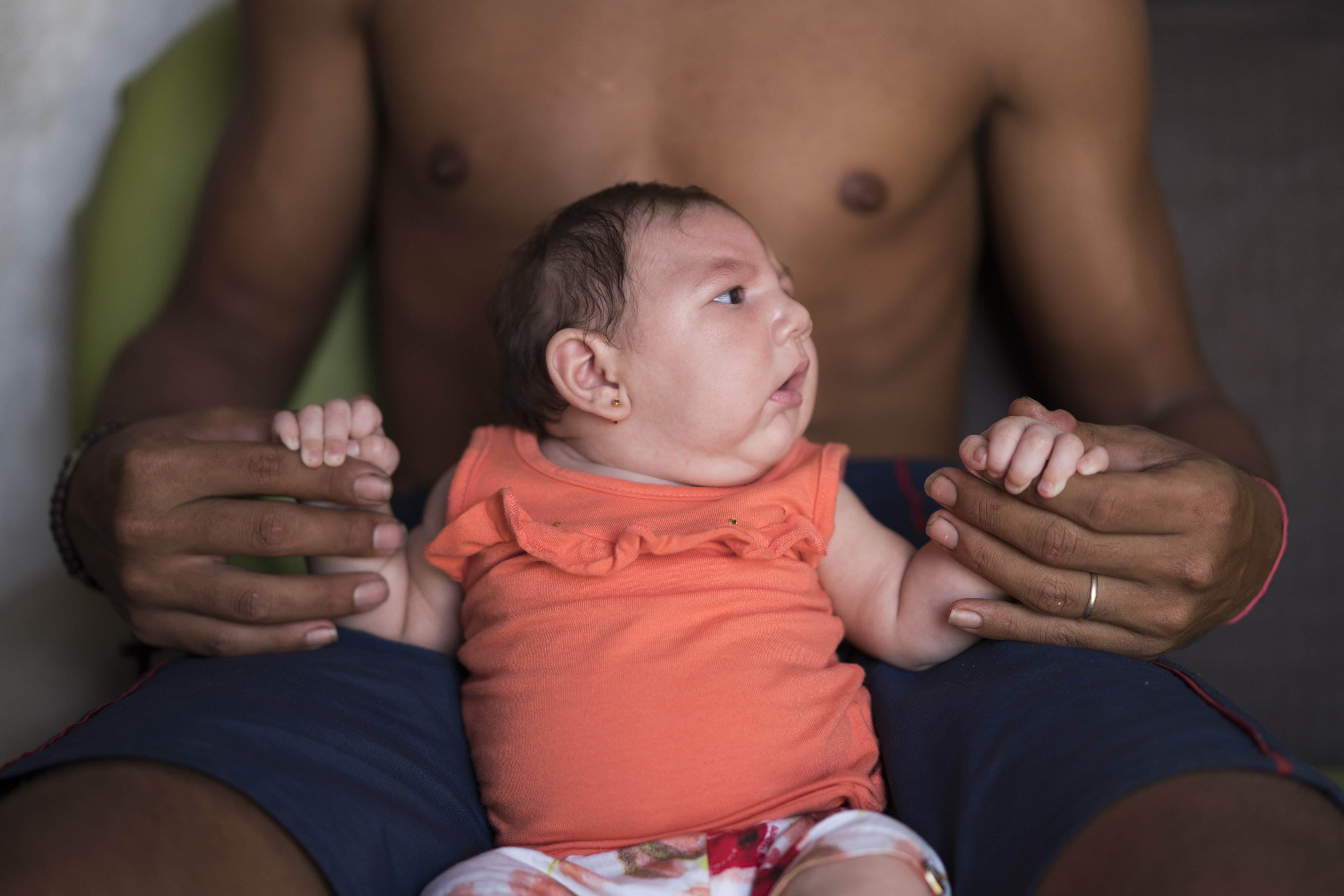In this Dec. 23, 2015 photo, Dejailson Arruda holds his daughter Luiza at their house in Santa Cruz do Capibaribe, Pernambuco state, Brazil. Luiza was born in October with a rare condition, known as microcephaly. Luiza's mother Angelica Pereira was infected with the Zika virus after a mosquito bite. Brazilian health authorities are convinced that Luiza's condition is related to the Zika virus that infected her mother during pregnancy. (AP Photo/Felipe Dana) 