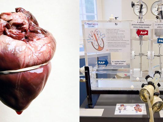 Zum 50 jährigen Jubliäum zeigt das Josephinum eine Ausstellung über Kunstherzen. Zum 50 jährigen Jubliäum zeigt das Josephinum eine Ausstellung über Kunstherzen.