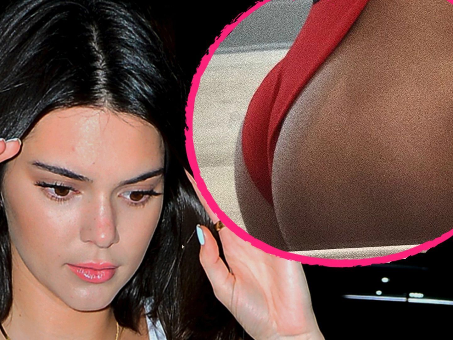 Ließ sich Kendall Jenner den Po operieren?