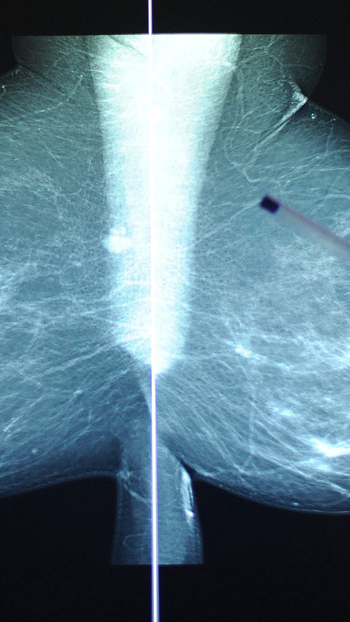 Das Krebsrisiko bei Frauen, die nachts arbeiten, ist deutlich höher als bei solchen, die untertags arbeiten.