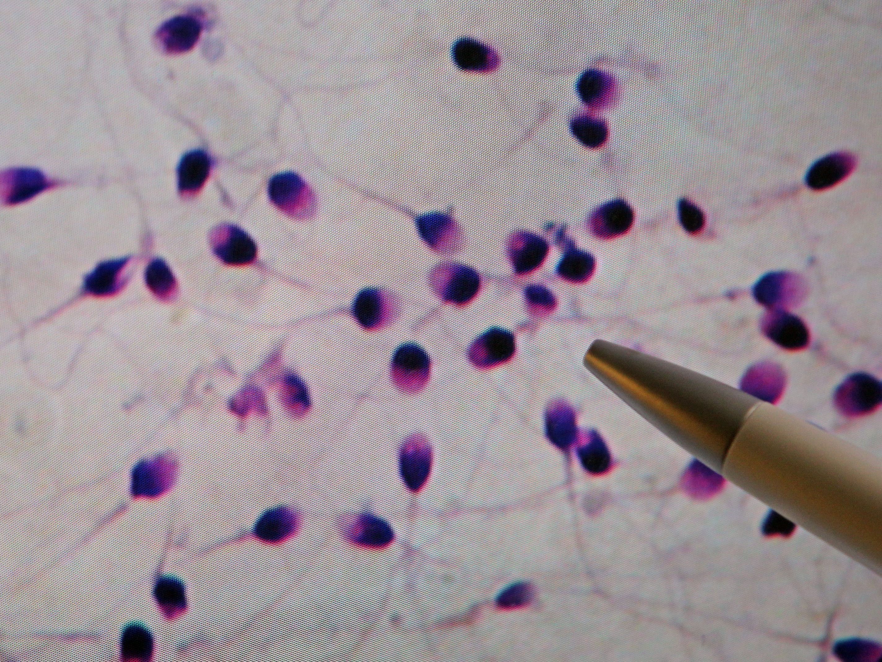 Sperma kann gefährlicher sein als gedacht. / Symbolbild