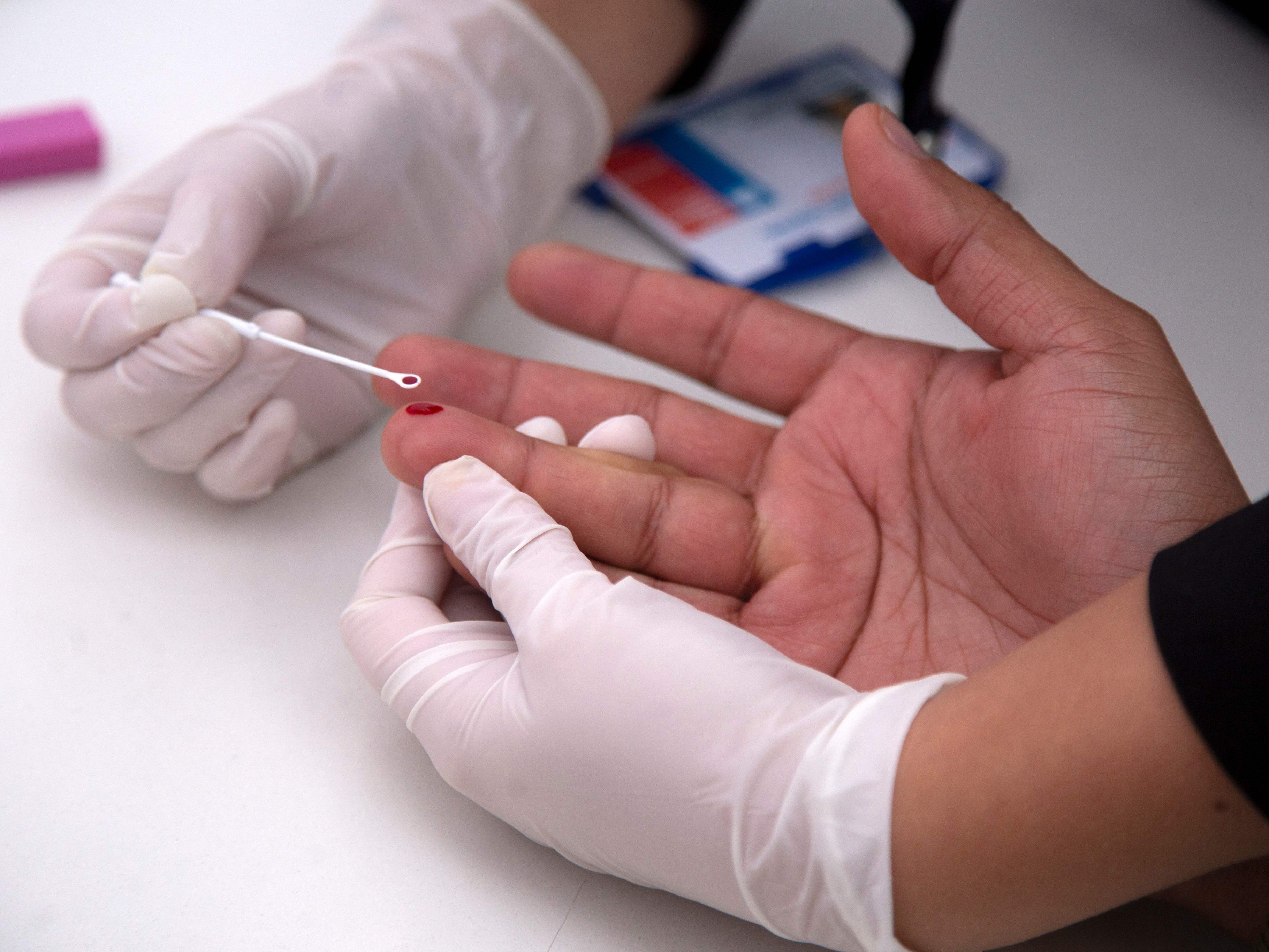 Ein Tropfen Blut reicht normalerweise aus, um seinen HIV-Status zu erfahren.