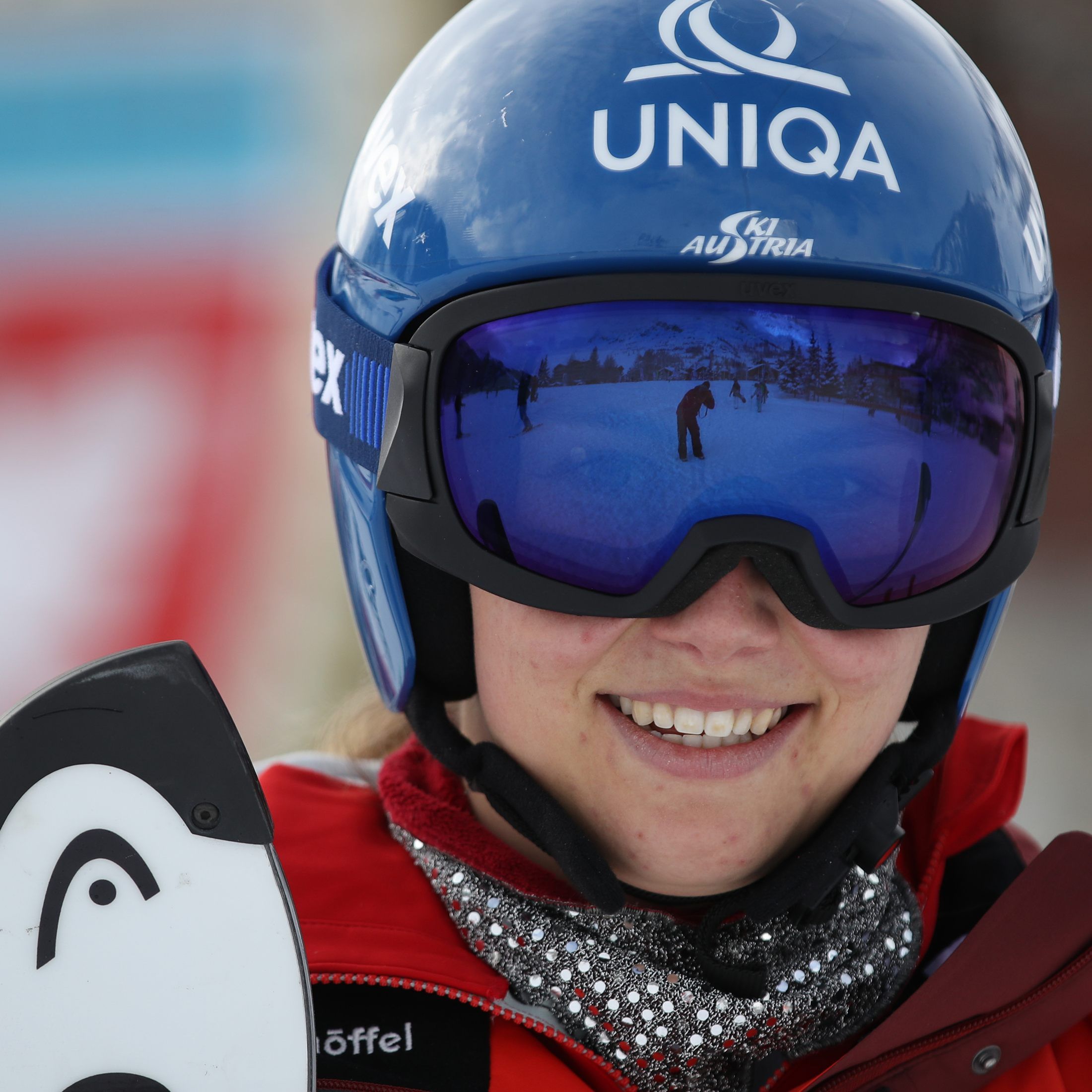 Scheyer musste sich einer Kreuzband-OP unterziehen.