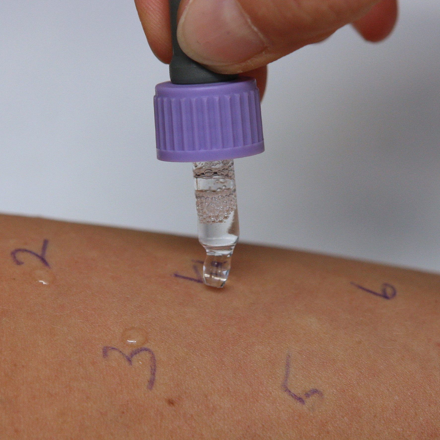 Allergien sollten nicht unbehandelt bleiben, um mögliche gesundheitliche Folgen wie Asthma zu vermeiden.