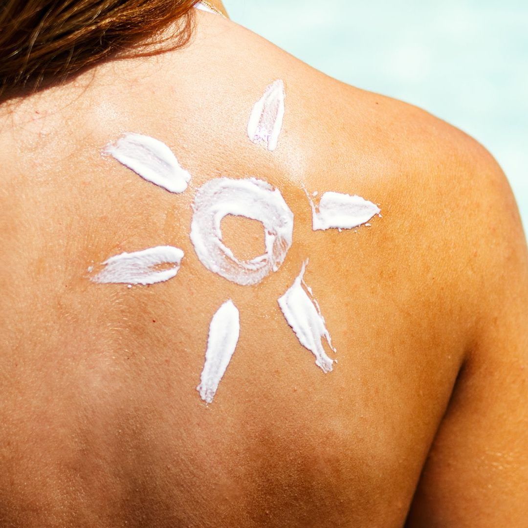 Diese Hausmittel helfen gegen Sonnenbrand.