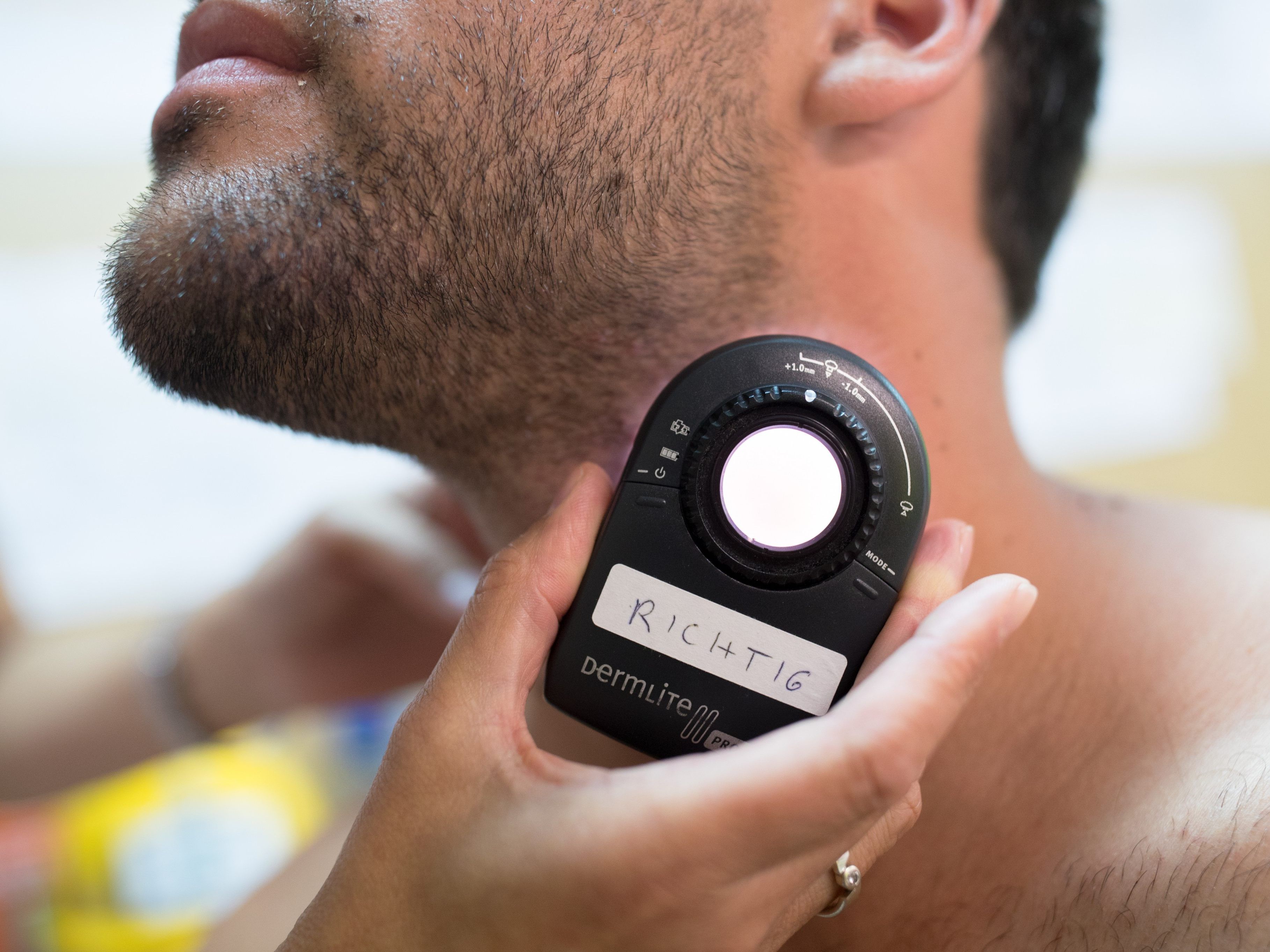 In Vorarlberg gibt es besonders viele Fälle.