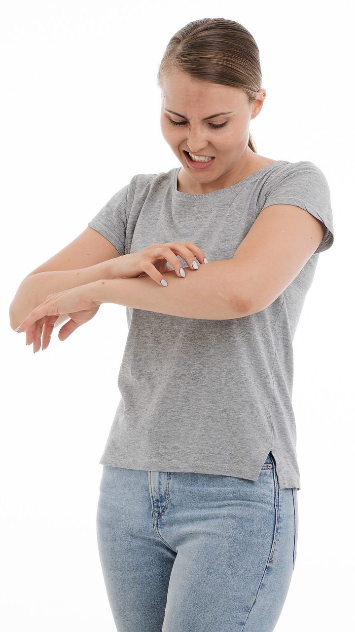 Krätze kann nur mit entsprechender Behandlung bekämpft werden.