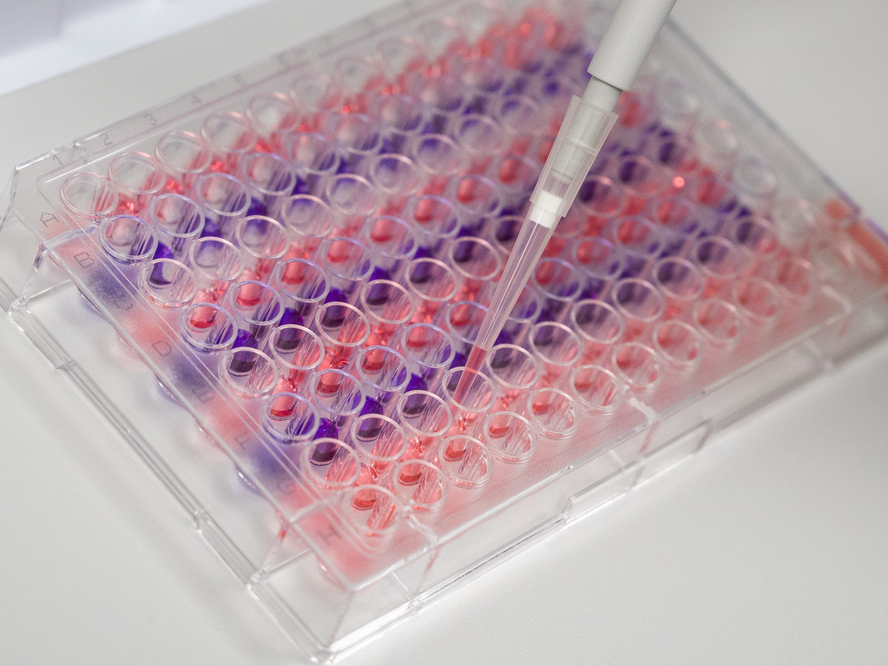 In Wien gibt es einen ersten Verdachtsfall des Coronavirus. In Wien gibt es einen ersten Verdachtsfall des Coronavirus.