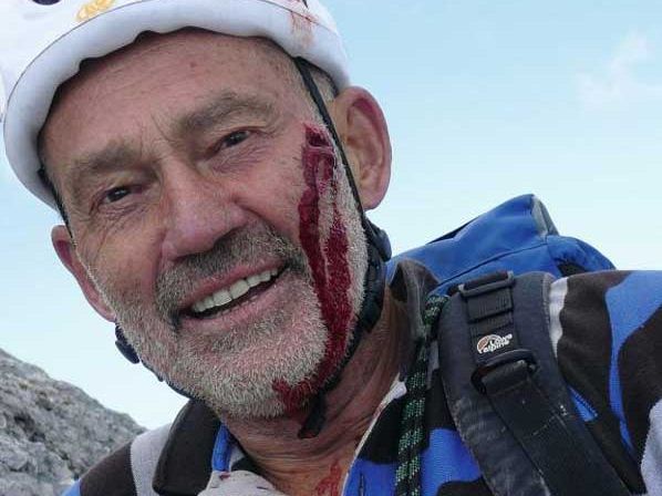 Hart im Nehmen: Immer wieder zog sich Oelz beim Klettern Verletzungen zu. Hart im Nehmen: Immer wieder zog sich Oelz beim Klettern Verletzungen zu.