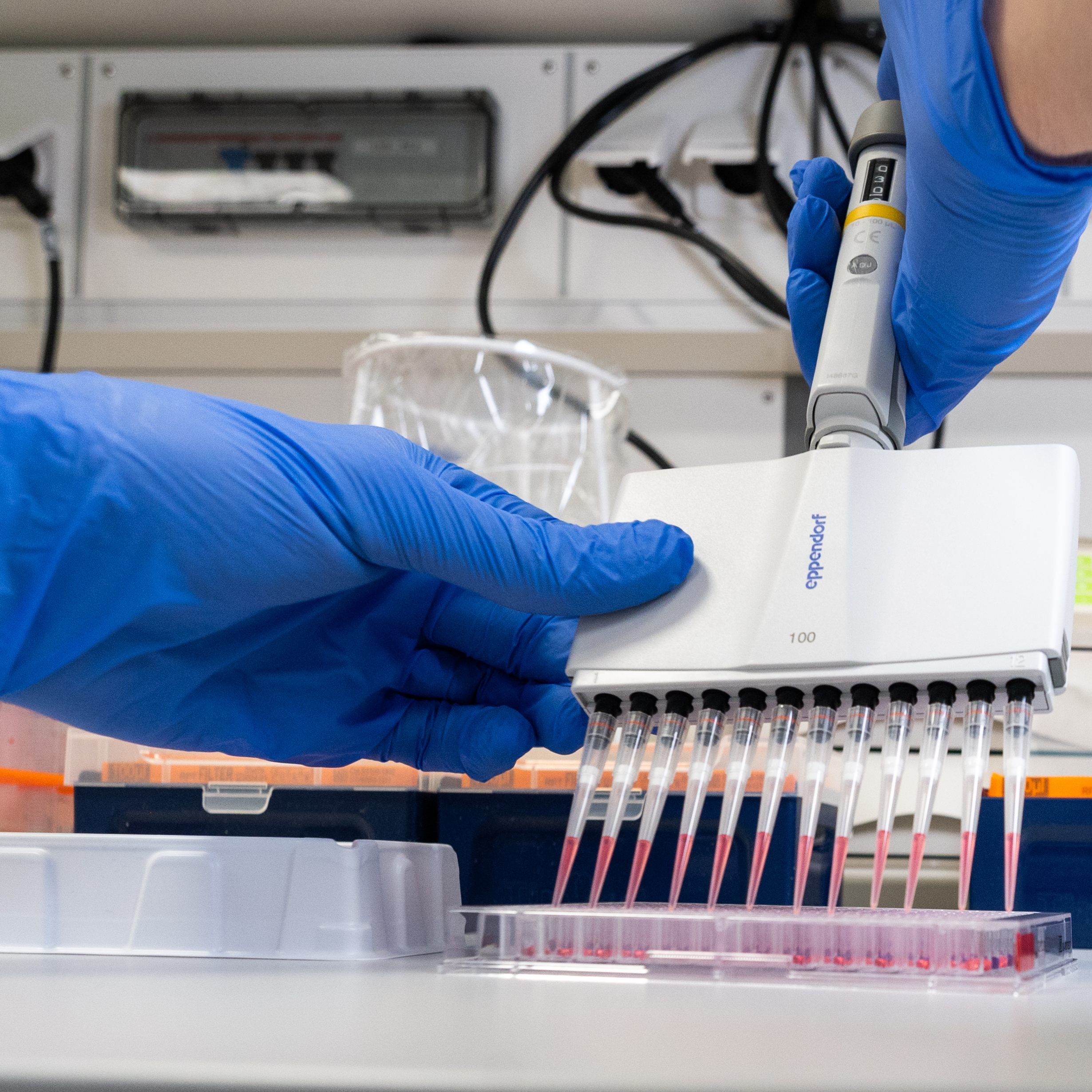 Beim zweiten Coronavirus_verdacht in Wien konnte bereits Entwarnung gegeben werden.