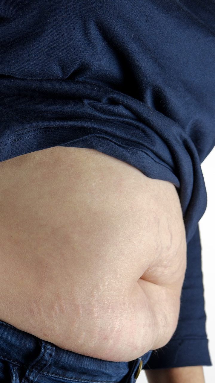 Kalorienreiche Ernährung und ein sitzender Lebensstil verursachen Übergewicht.