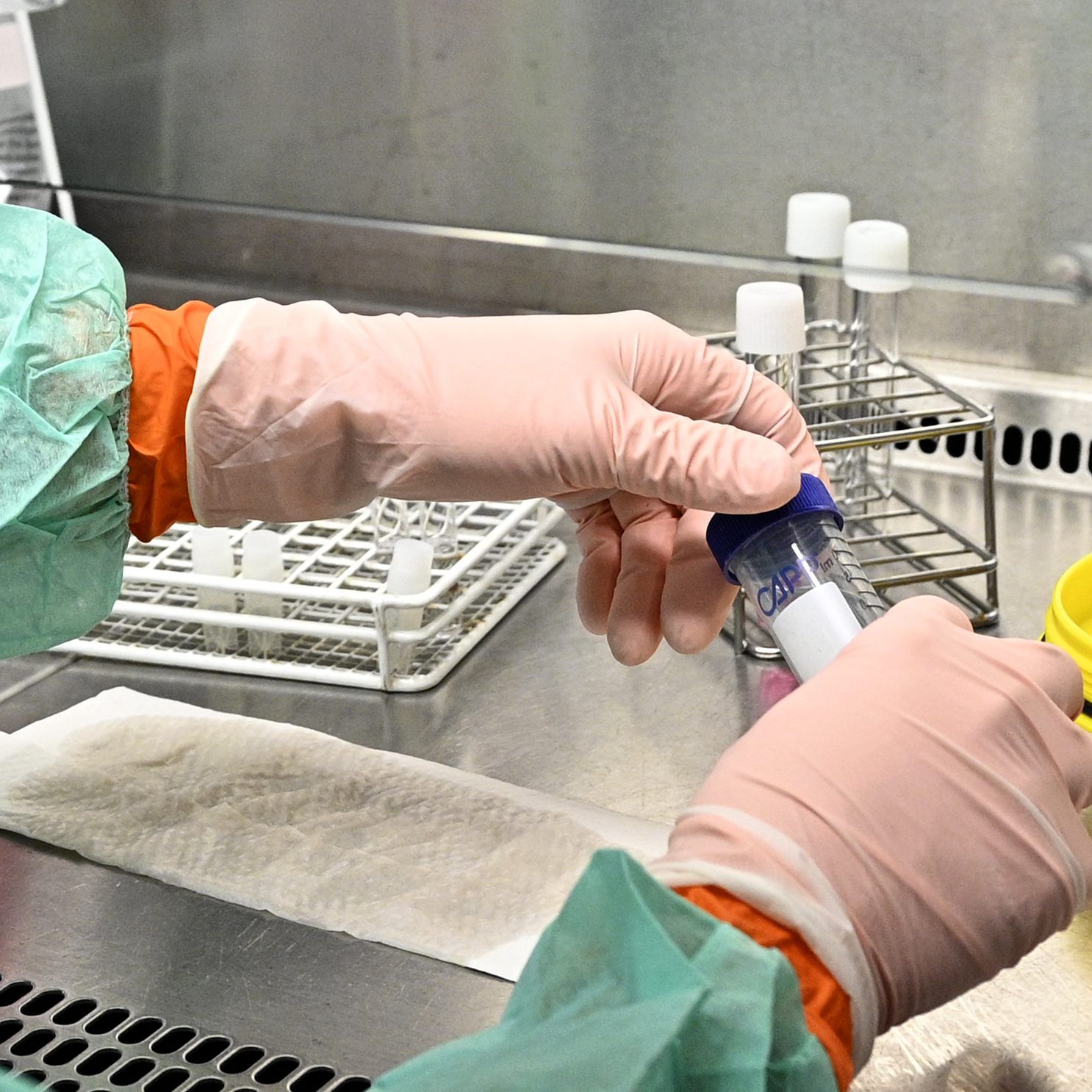 Der Wirkstoff soll Schädigungen der Lunge eindämmen und Organversagen verhindern.