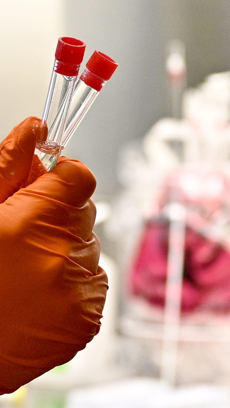 Auch im zweiten Coronavirus-Verdachtsfall in Vorarlberg konnte Entwarnung gegeben werden.
