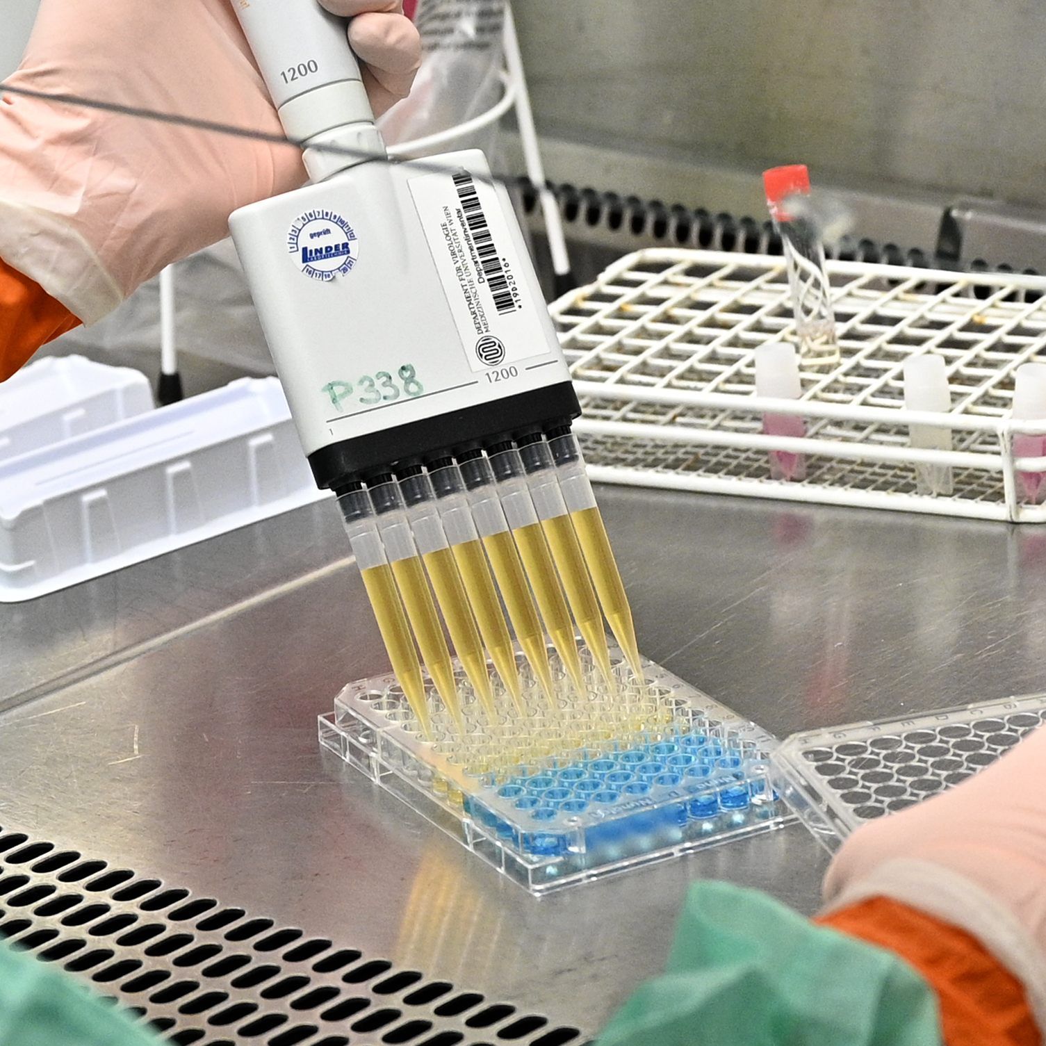 Auch der dritte Corona-Verdachtsfall in Liechtenstein stellte sich als negativ heraus.