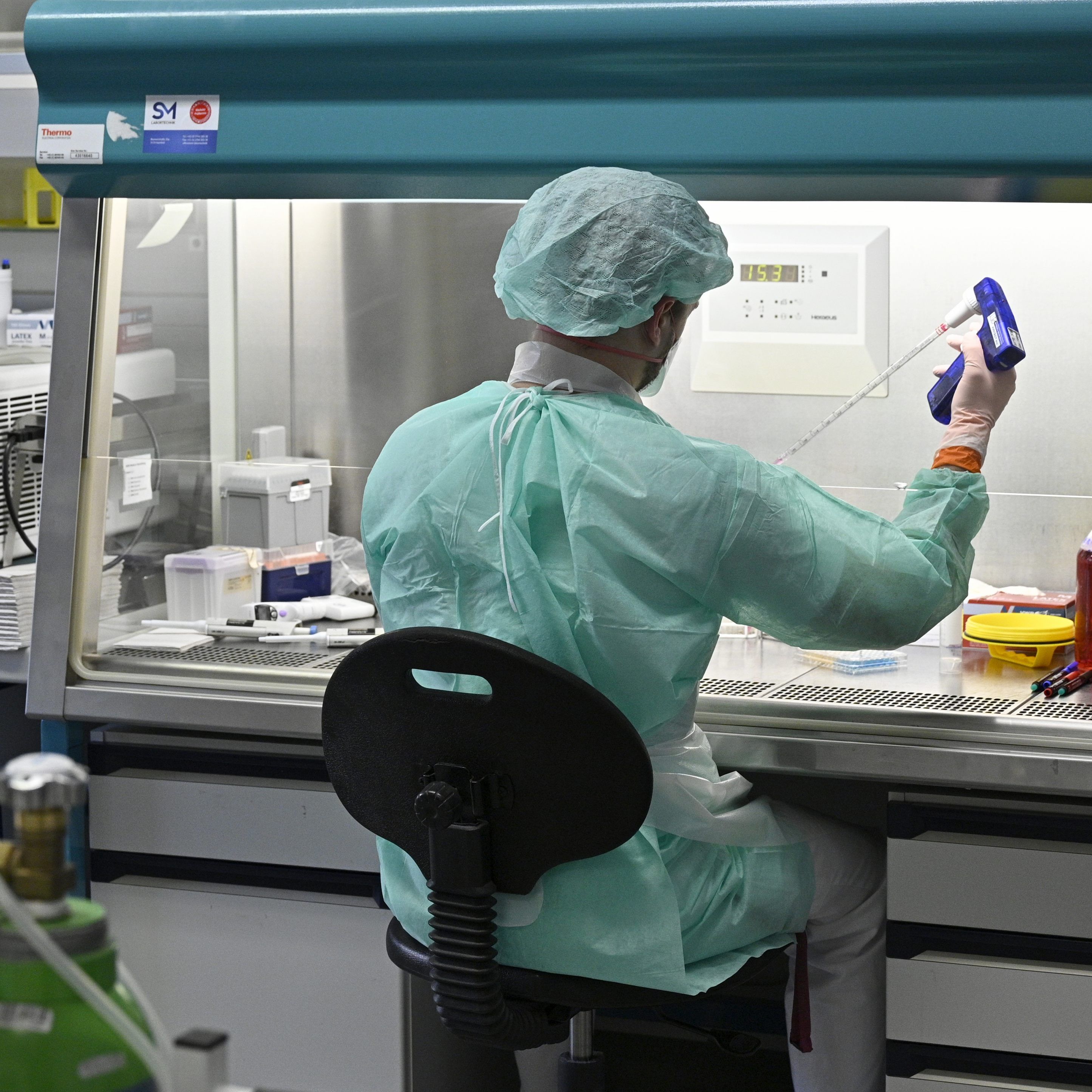 Bisher wurden in Österreich 157 Coronavirus-Tests durchgeführt.