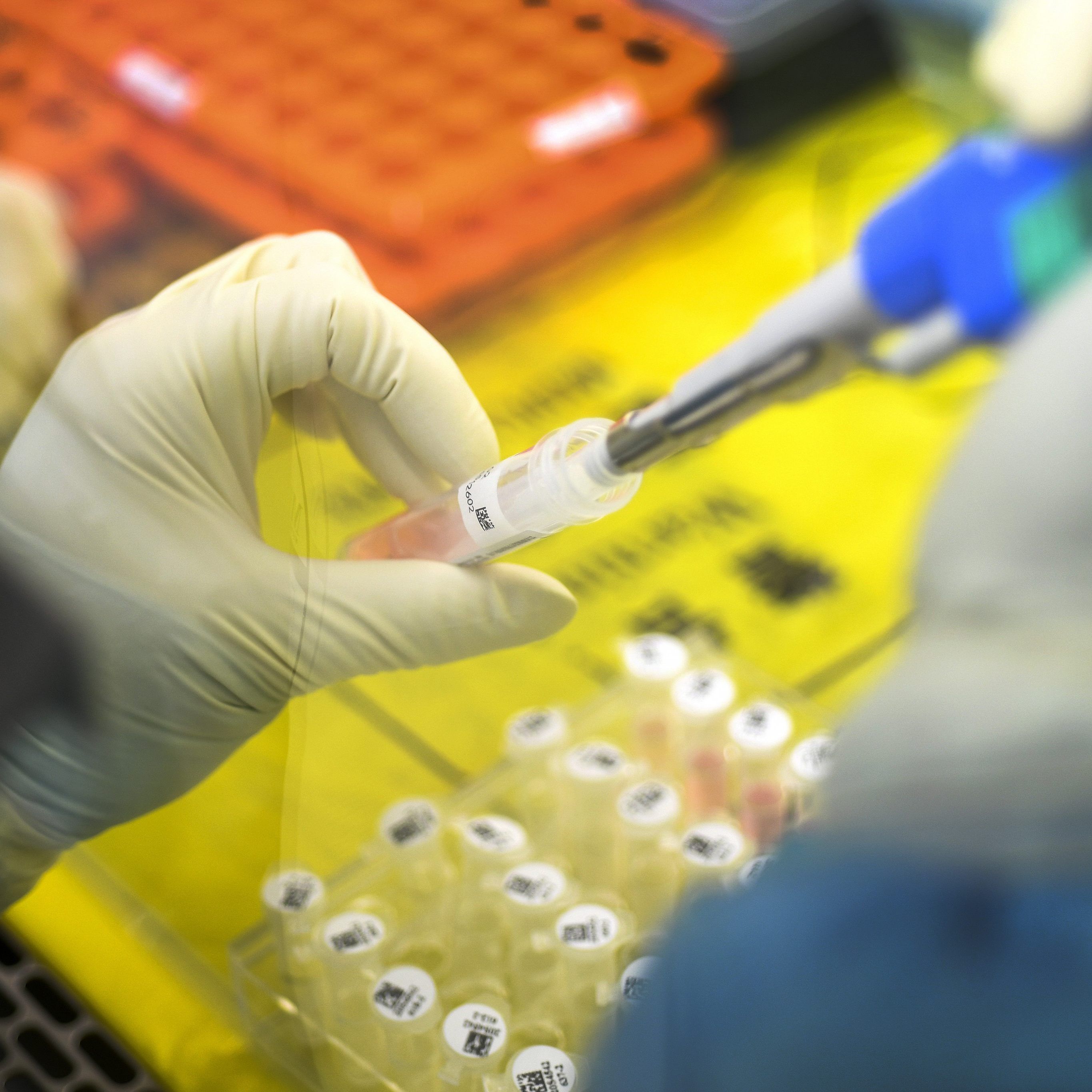 Ein junger Mann befindet sich mit Symptomen in Quarantäne.