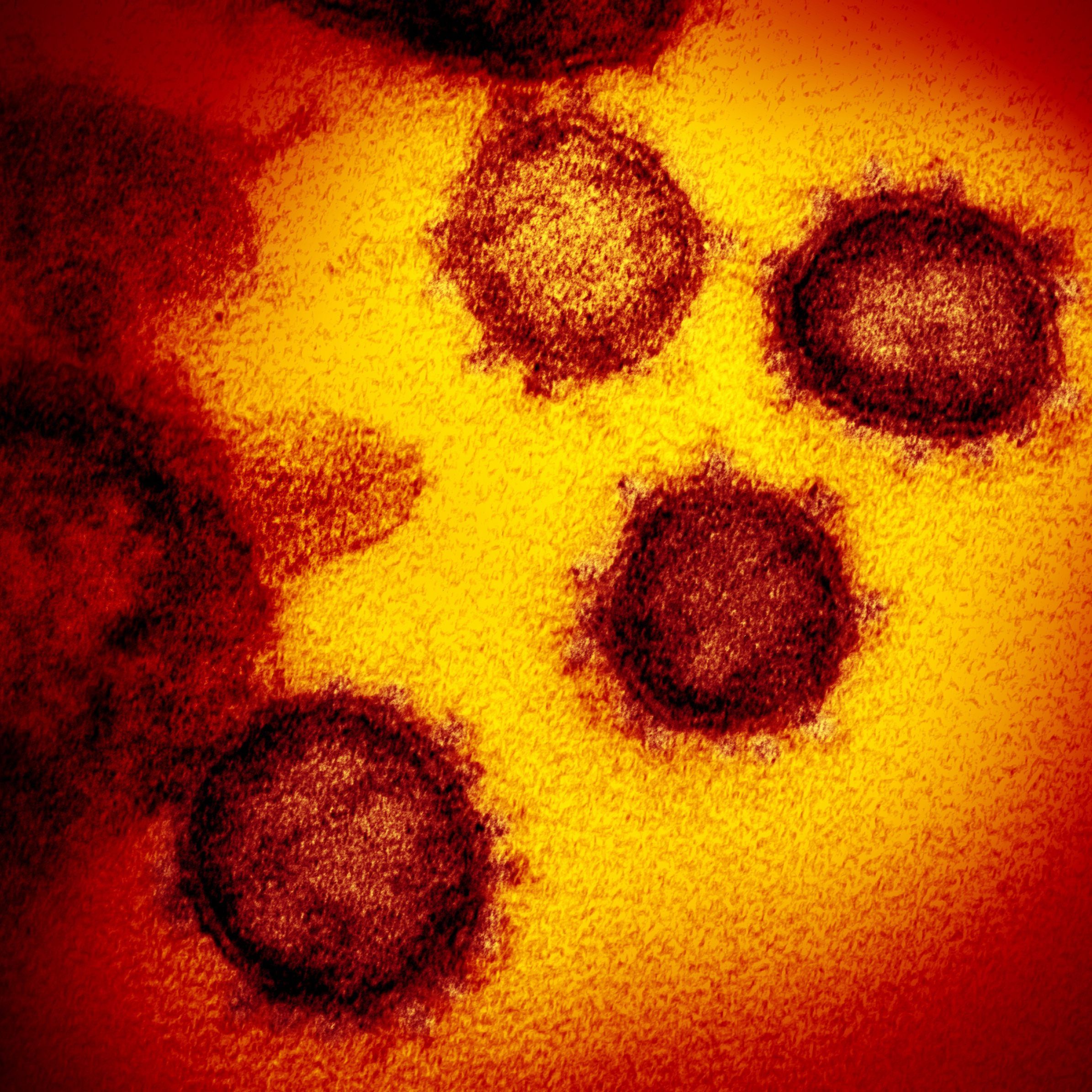 Rund um das Coronavirus ranken sich bereits zahlreiche Mythen.