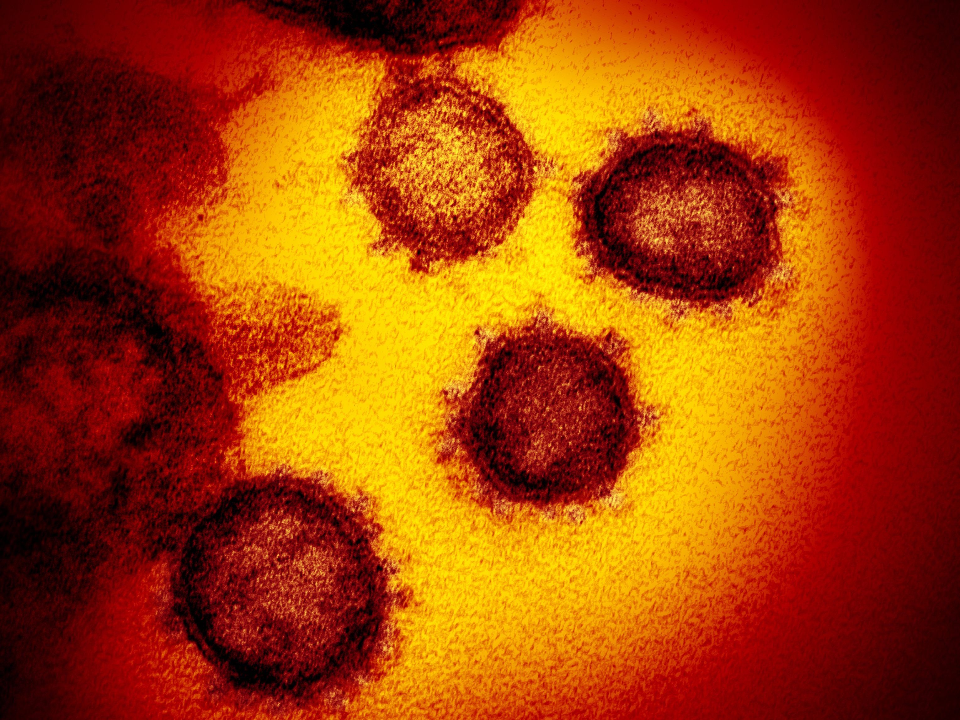 Rund um das Coronavirus ranken sich bereits zahlreiche Mythen. Rund um das Coronavirus ranken sich bereits zahlreiche Mythen.