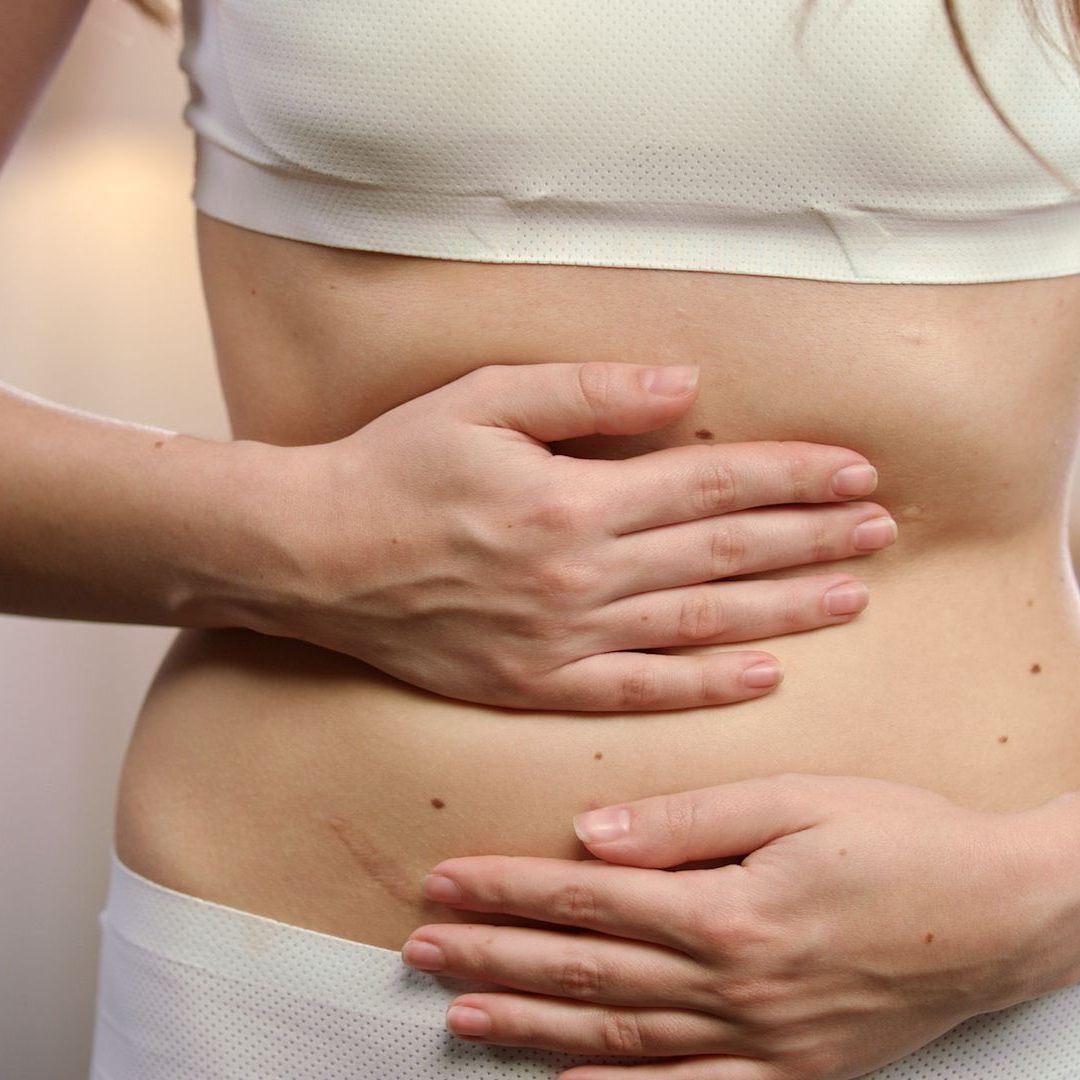 Wer starke Menstruationsschmerzen hat, könnte unter Endometriose leiden.