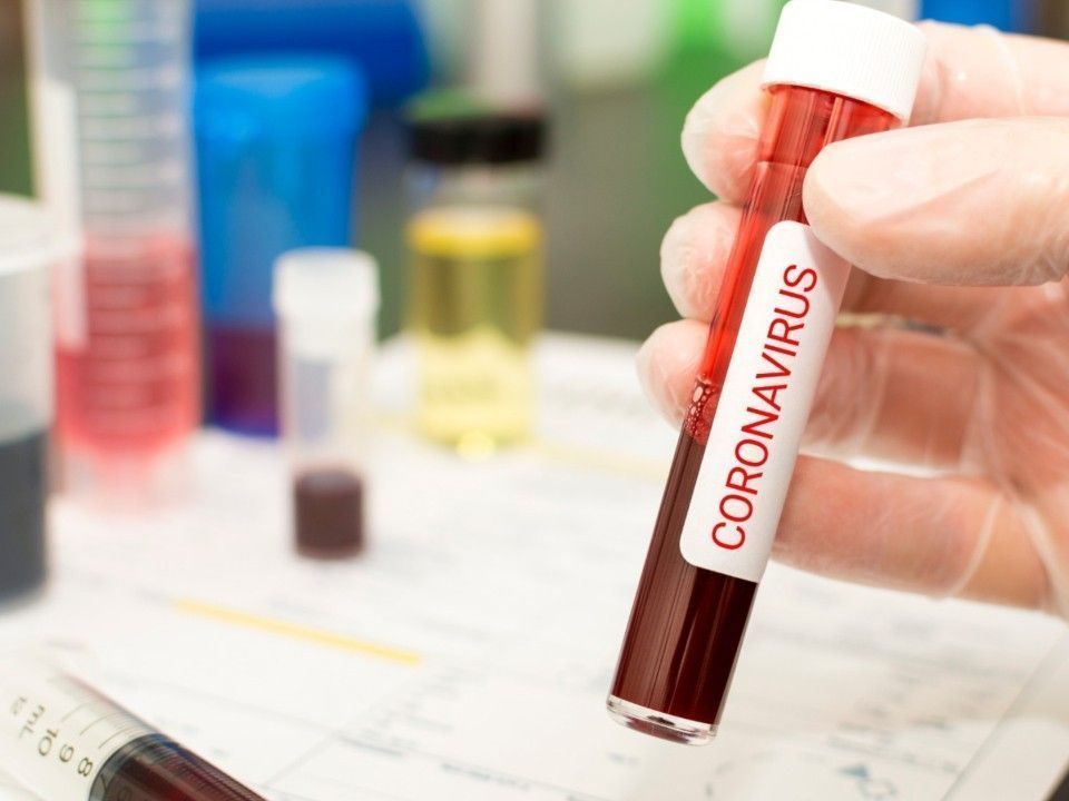 Besonders für Infizierte über 80 Jahren ist das Coronavirus lebensgefährlich. Besonders für Infizierte über 80 Jahren ist das Coronavirus lebensgefährlich.