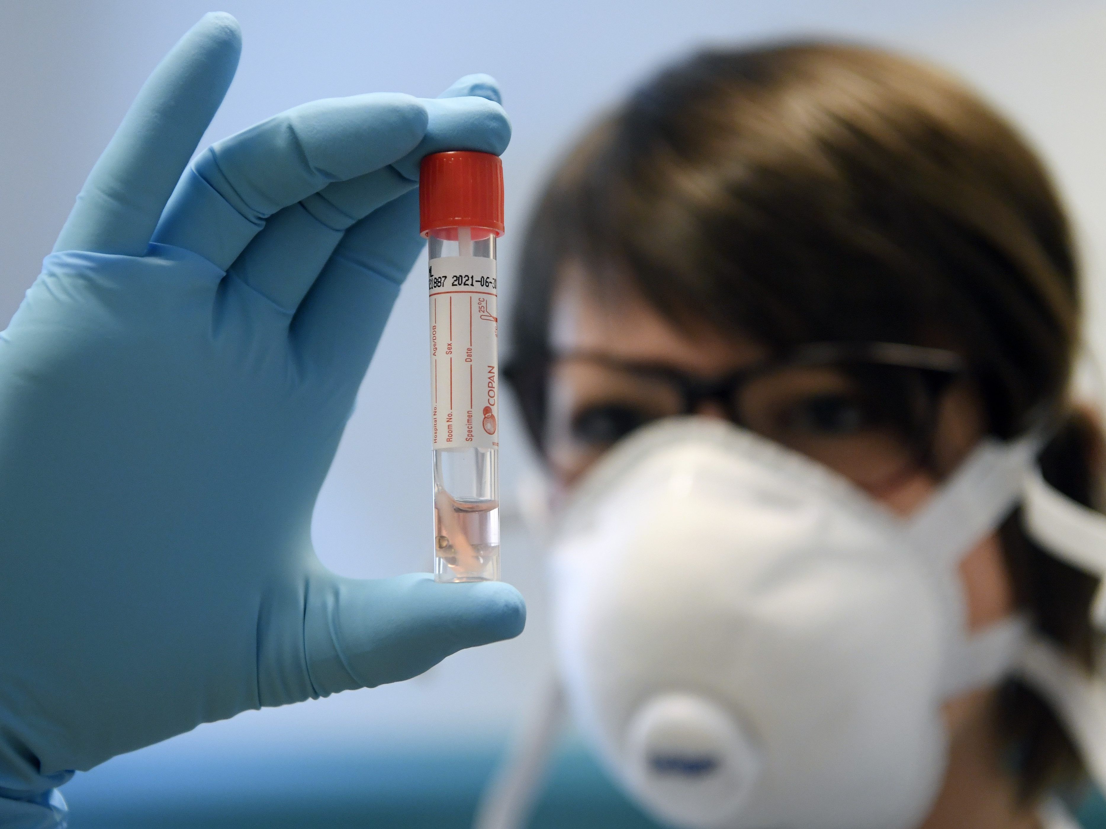 Drei weitere Personen wurden in dem Wiener Pensionistenwohnheim mit dem Coronavirus angesteckt. Drei weitere Personen wurden in dem Wiener Pensionistenwohnheim mit dem Coronavirus angesteckt.
