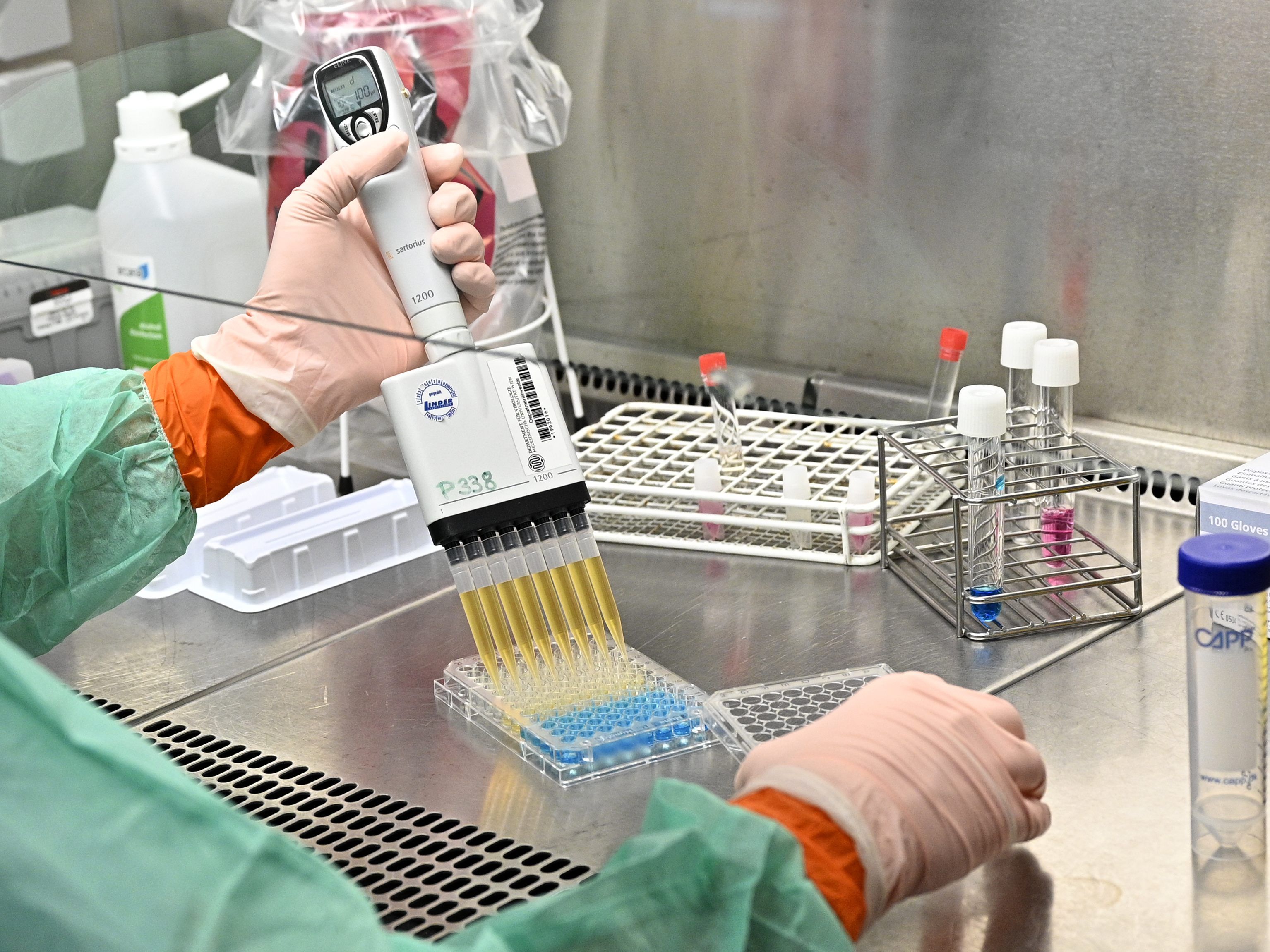 Bisher wurden in Österreich 206 Patienten positiv auf das Coronavirus getestet. Bisher wurden in Österreich 206 Patienten positiv auf das Coronavirus getestet.