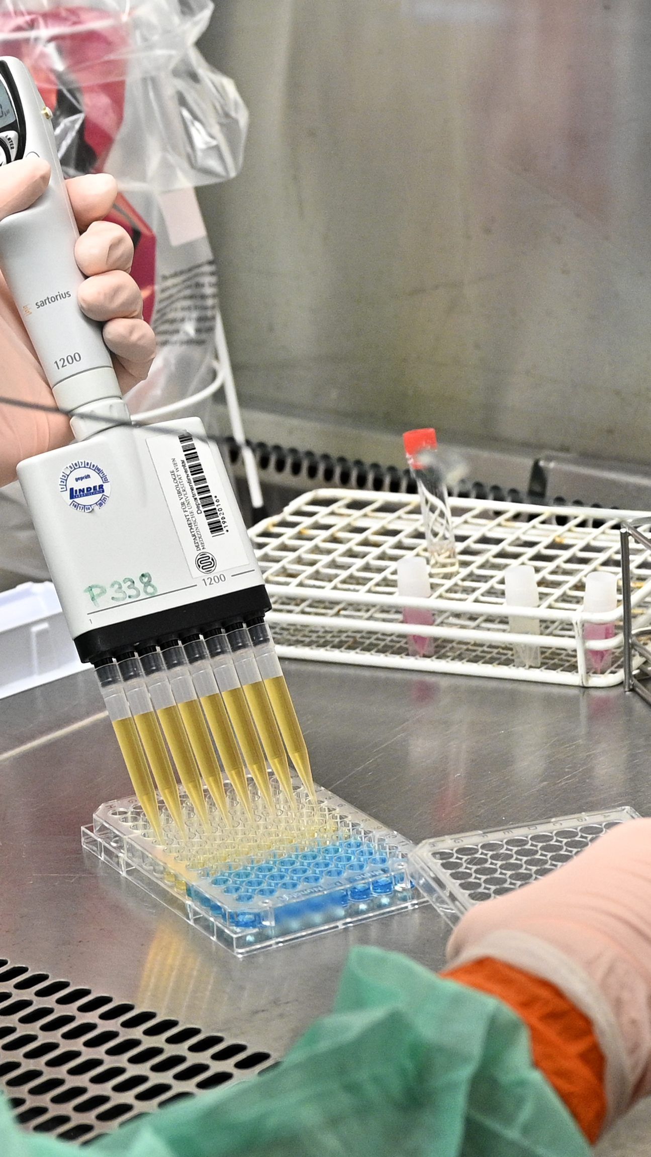 Bisher wurden in Österreich 206 Patienten positiv auf das Coronavirus getestet.