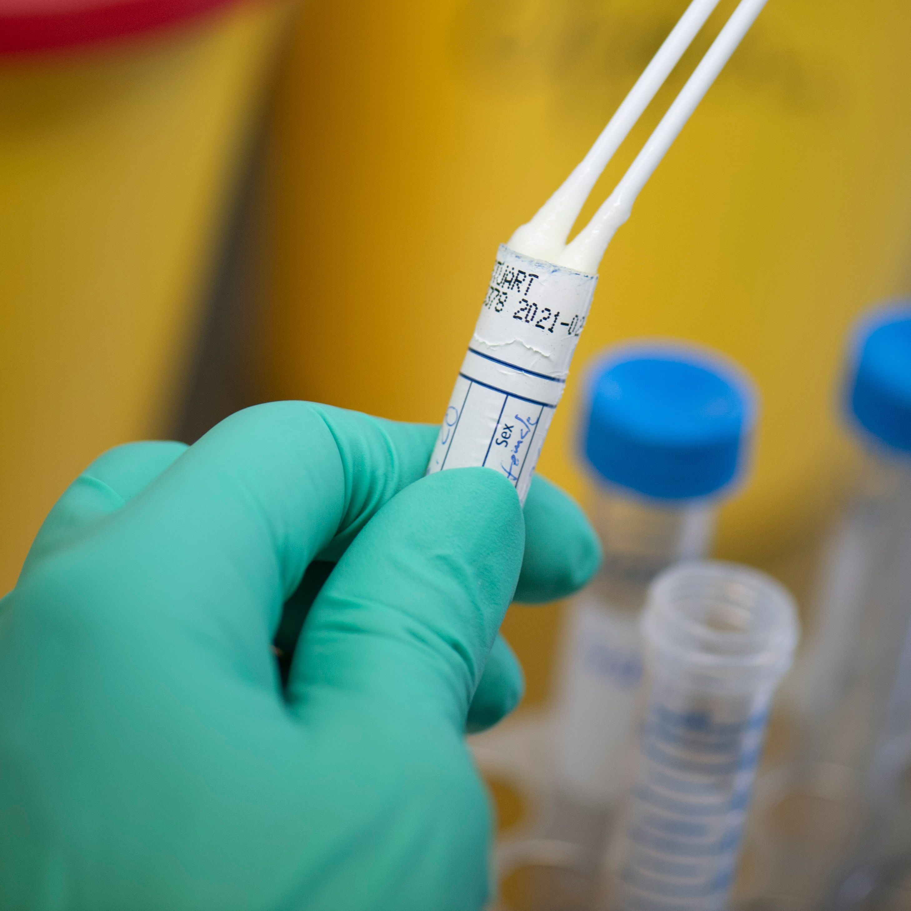 Im Folgenden Tipps, wann man sich testen lassen sollte und wann nicht.