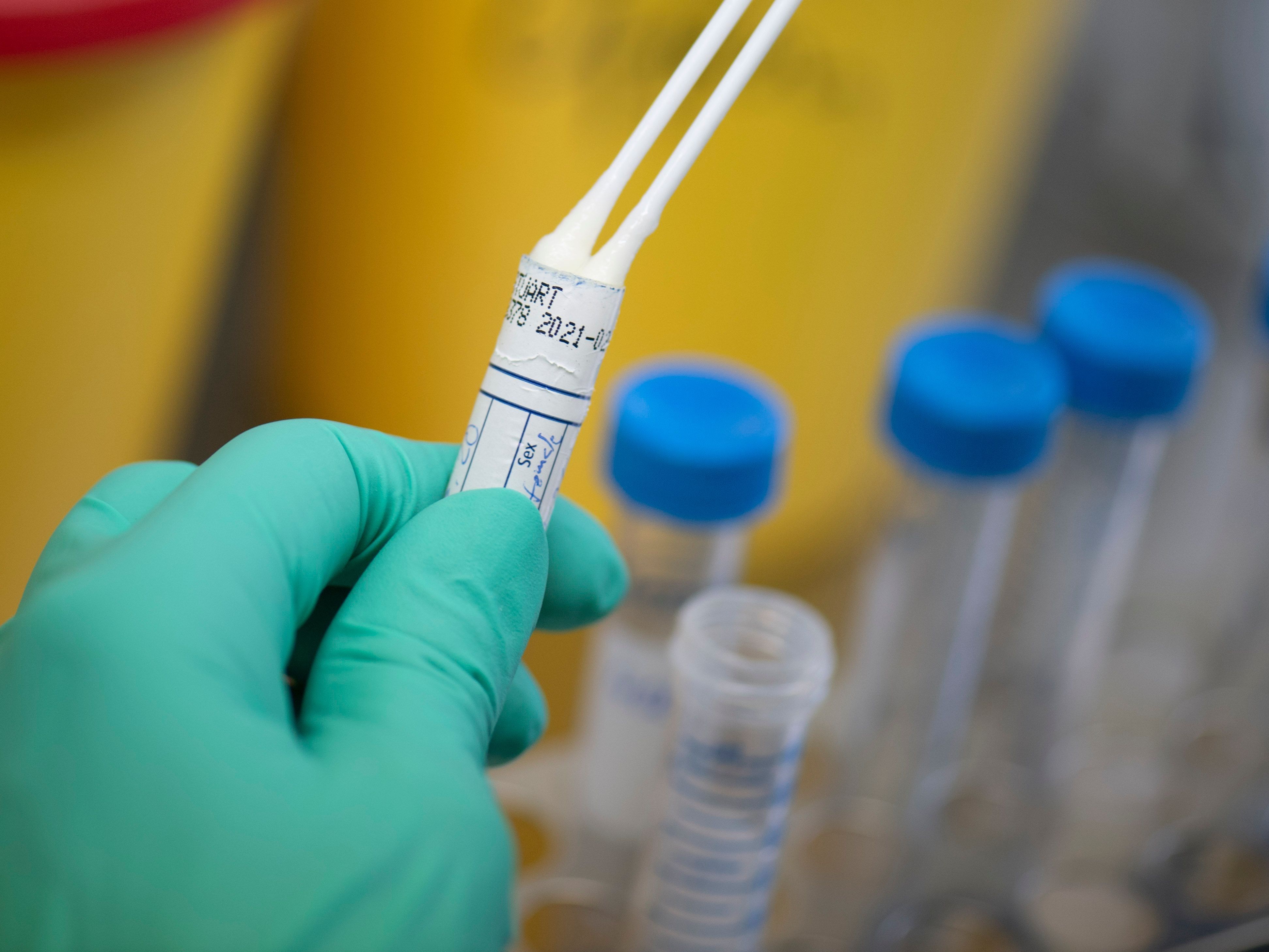 Im Folgenden Tipps, wann man sich testen lassen sollte und wann nicht. Im Folgenden Tipps, wann man sich testen lassen sollte und wann nicht.