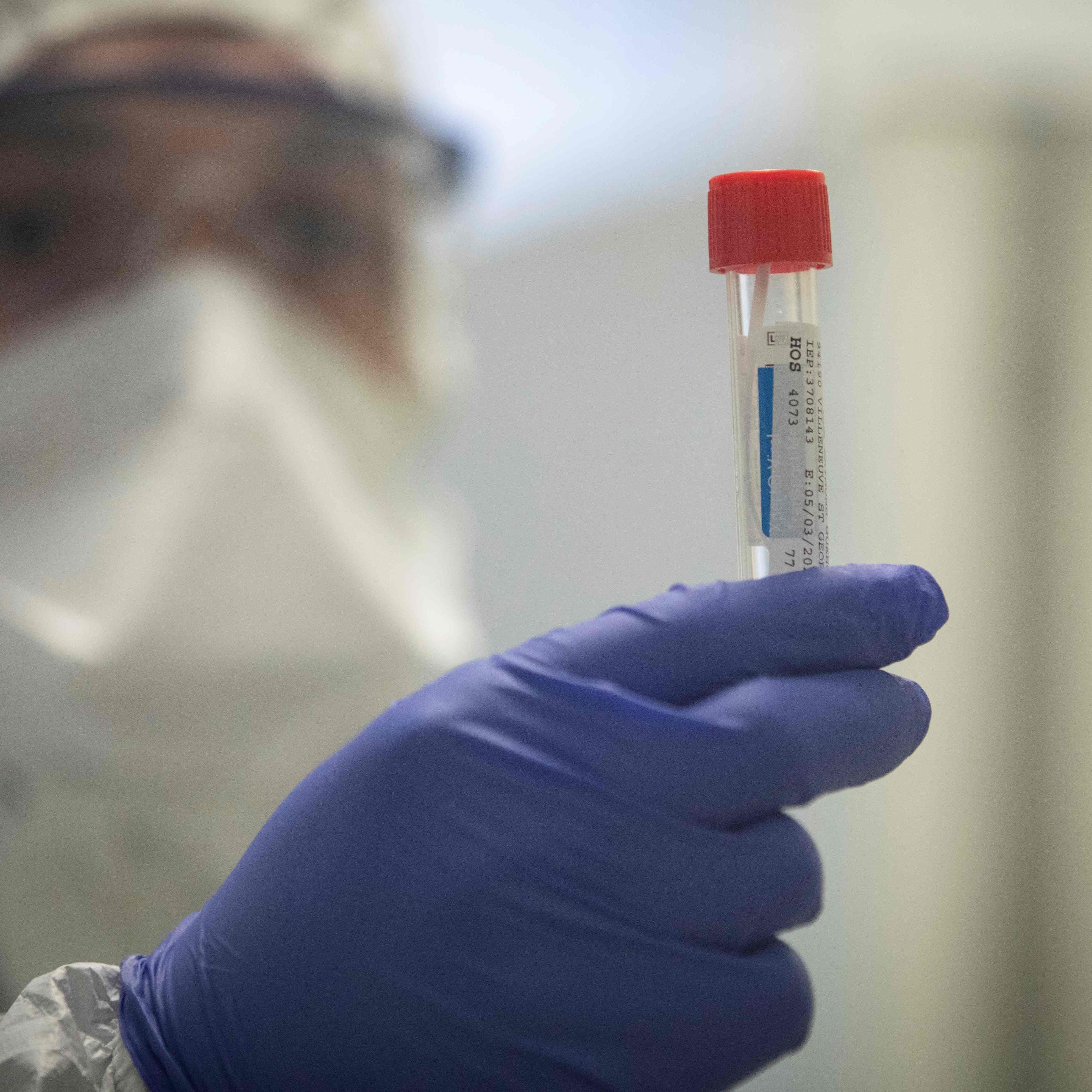 Am Freitag gab es in Österreich 55 bestätigte Coronavirus-Fälle.