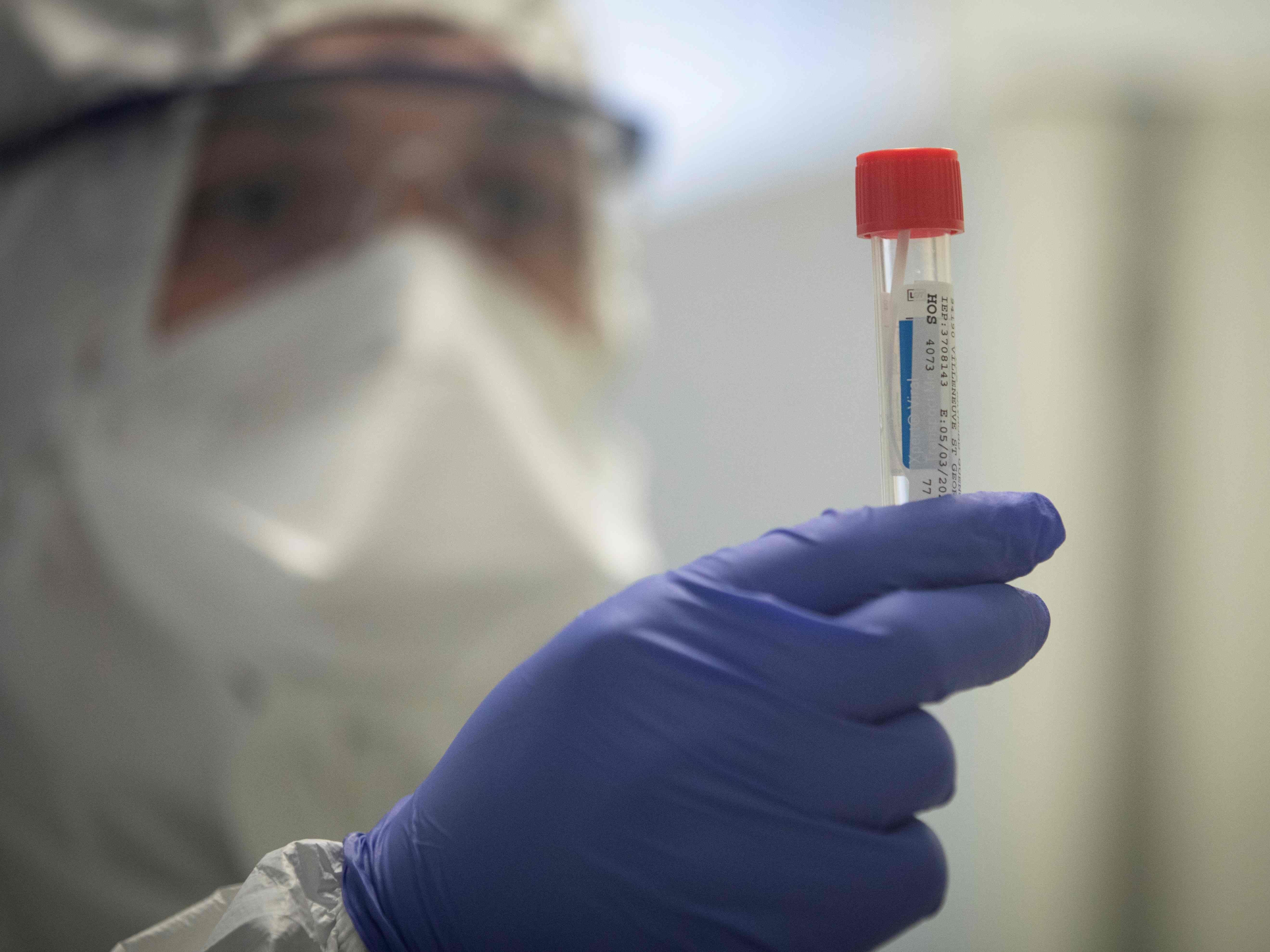 4.734 Tests wurden bisher durchgeführt. 4.734 Tests wurden bisher durchgeführt.