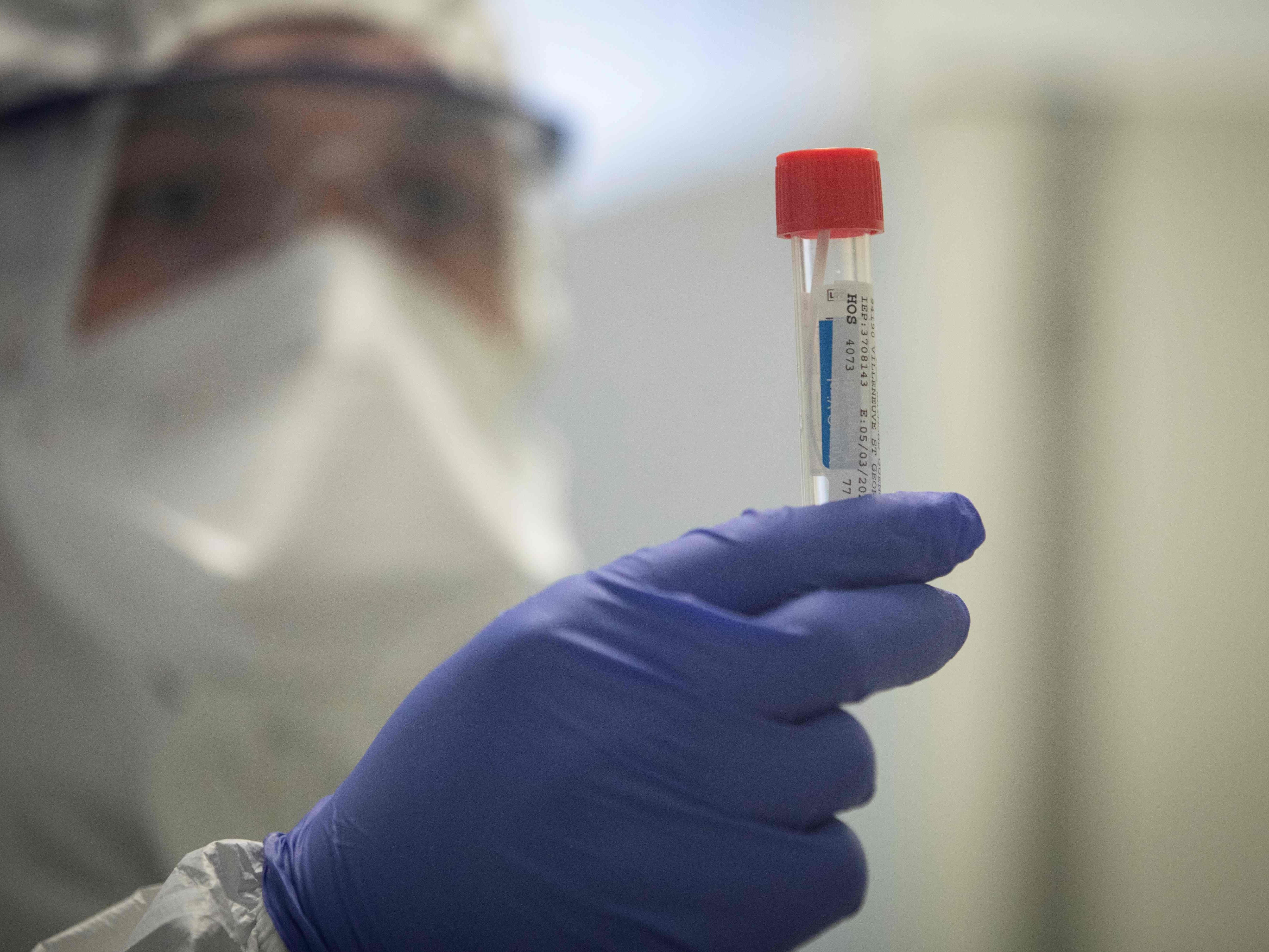 Am Freitag gab es in Österreich 55 bestätigte Coronavirus-Fälle. Am Freitag gab es in Österreich 55 bestätigte Coronavirus-Fälle.