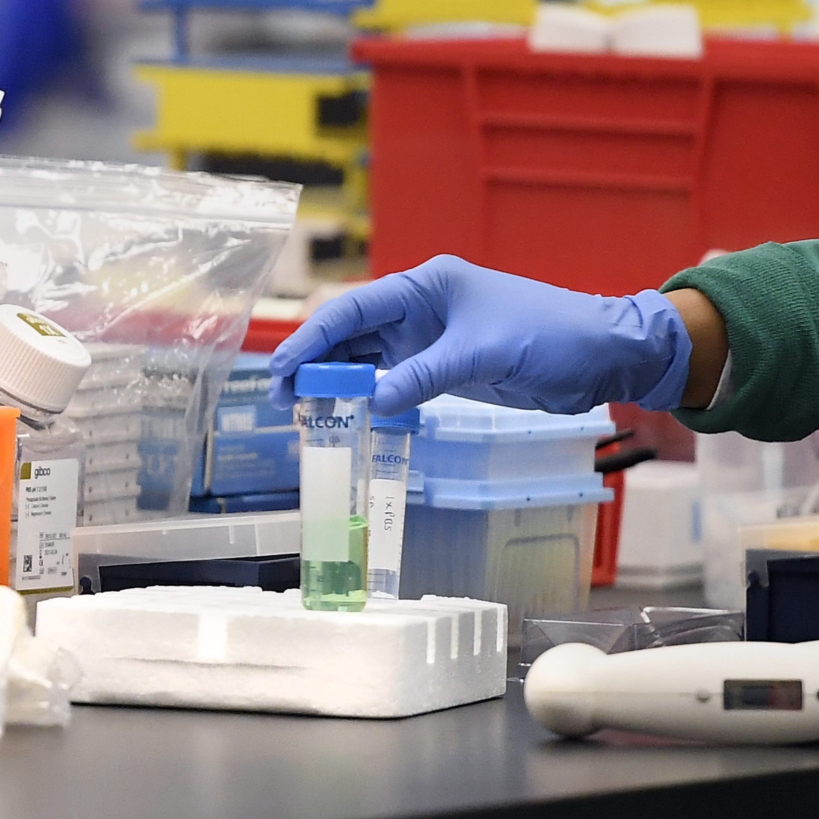 Das Coronavirus könnte sich beim höheren Temperaturen "verlangsamen".