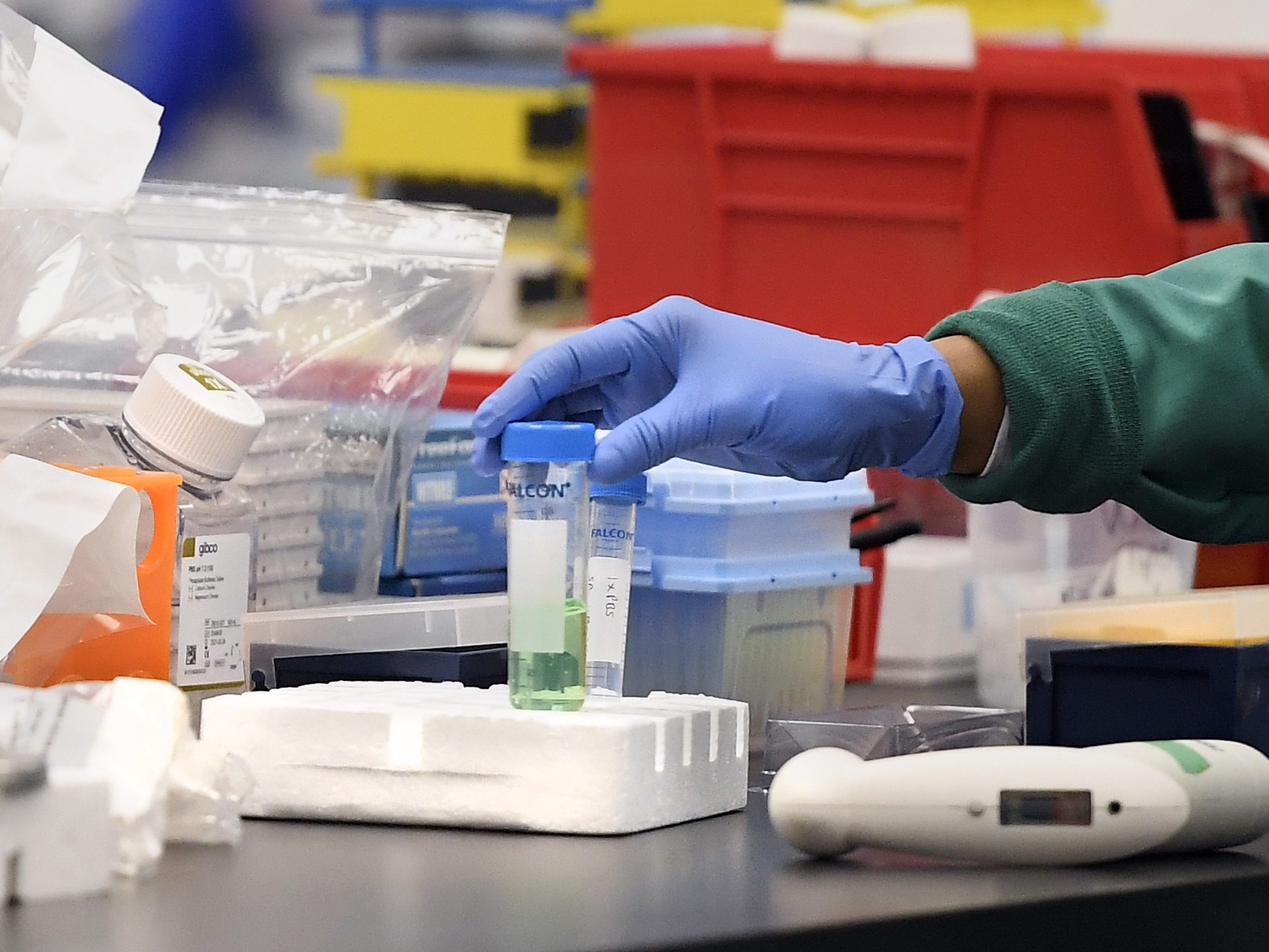 Das Coronavirus könnte sich beim höheren Temperaturen "verlangsamen". Das Coronavirus könnte sich beim höheren Temperaturen "verlangsamen".