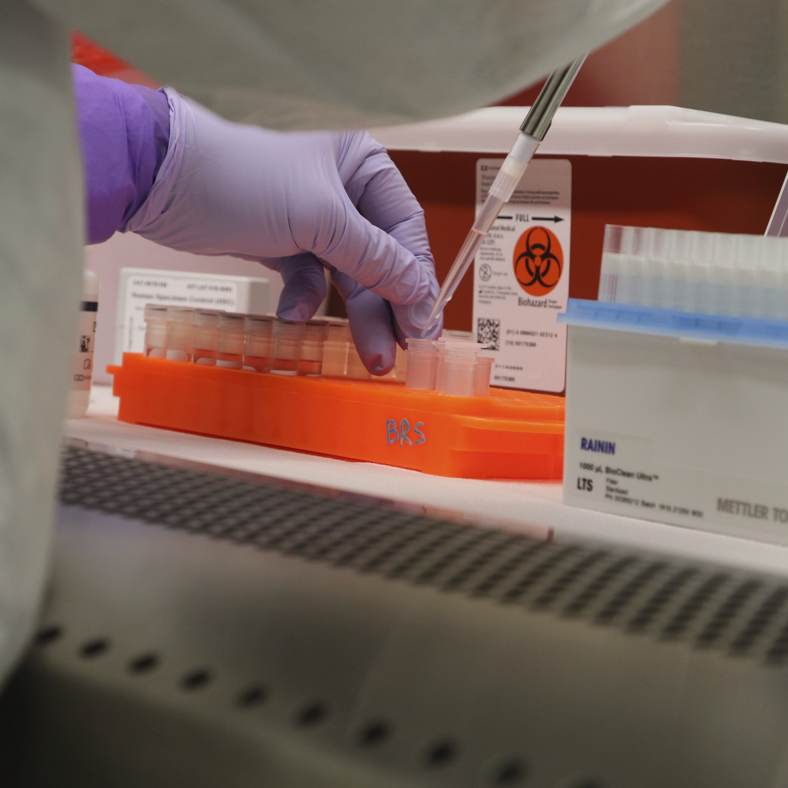 Vier weitere Personen wurden positiv auf Covid-19 getestet.