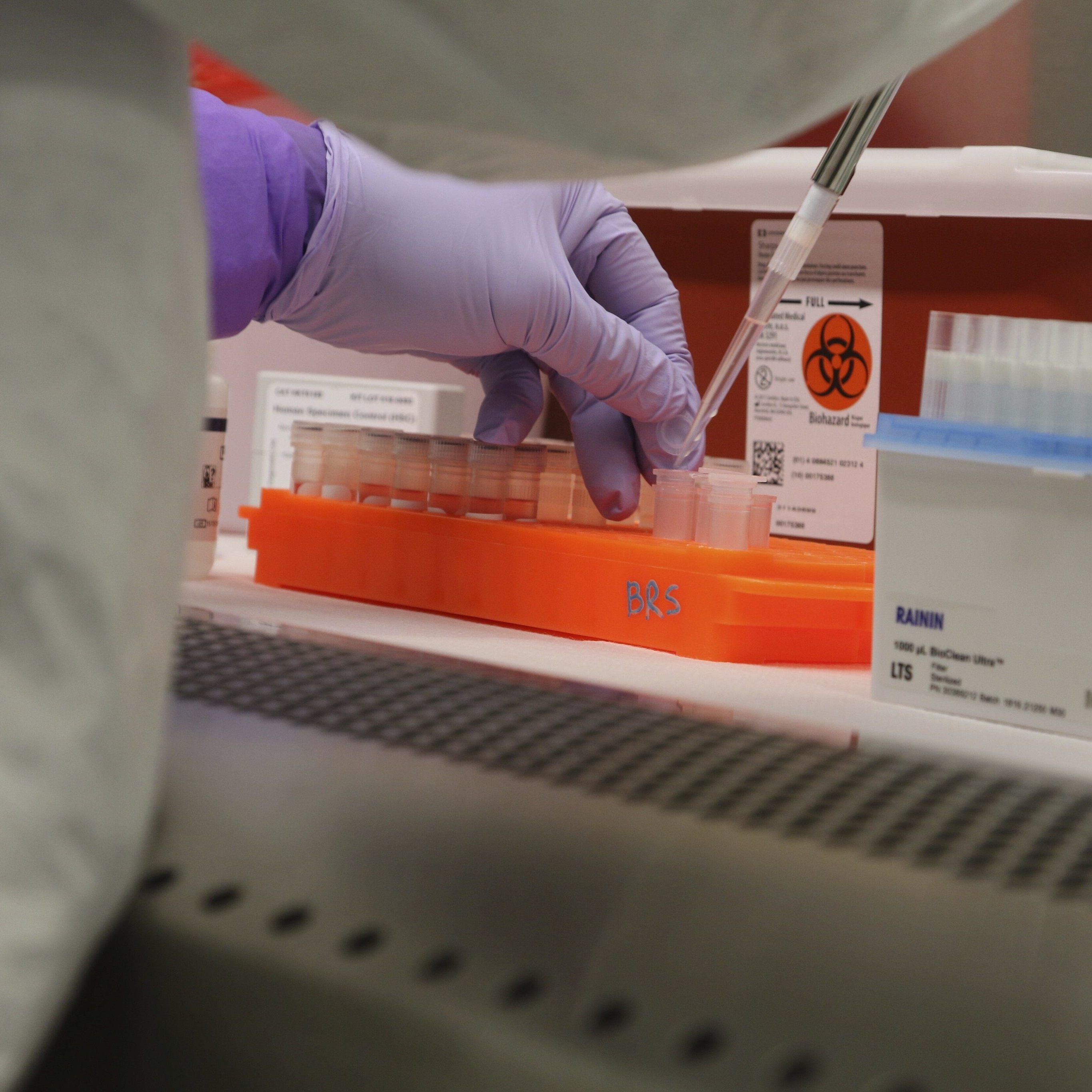 Die Zahl der Coronavirus-Infektionen lag am Mittwoch bei 1.471.