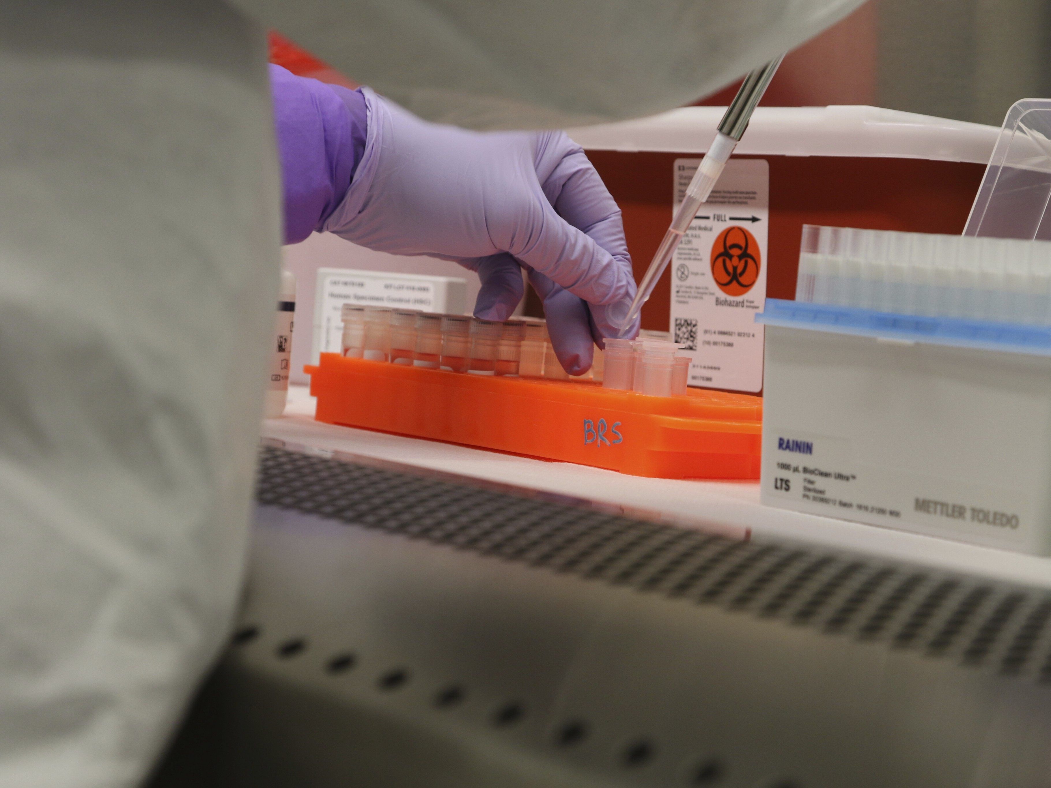 Die Zahl der Coronavirus-Infektionen lag am Mittwoch bei 1.471. Die Zahl der Coronavirus-Infektionen lag am Mittwoch bei 1.471.