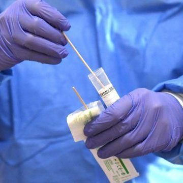 Bei den Coronavirus-Antikörpertests heißt es "Bitte warten".