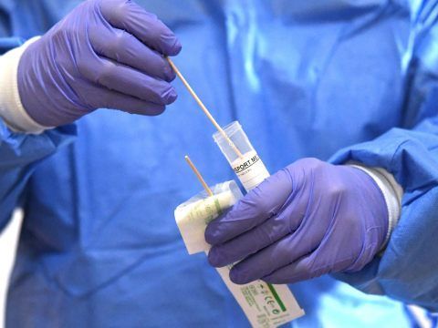 Die Stadt Wien vergibt Sonder-Fördergelder zur Forschung an dem Coronavirus.