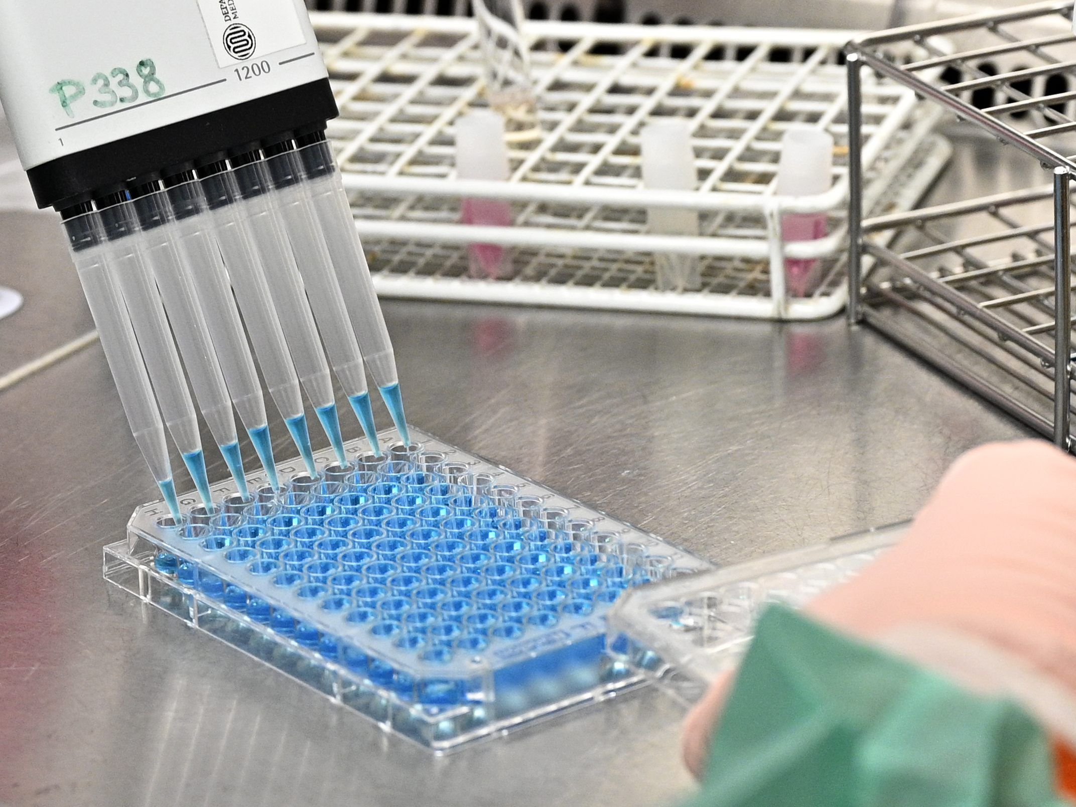 In den kommenden Tagen sollen 540 Personen untersucht werden.