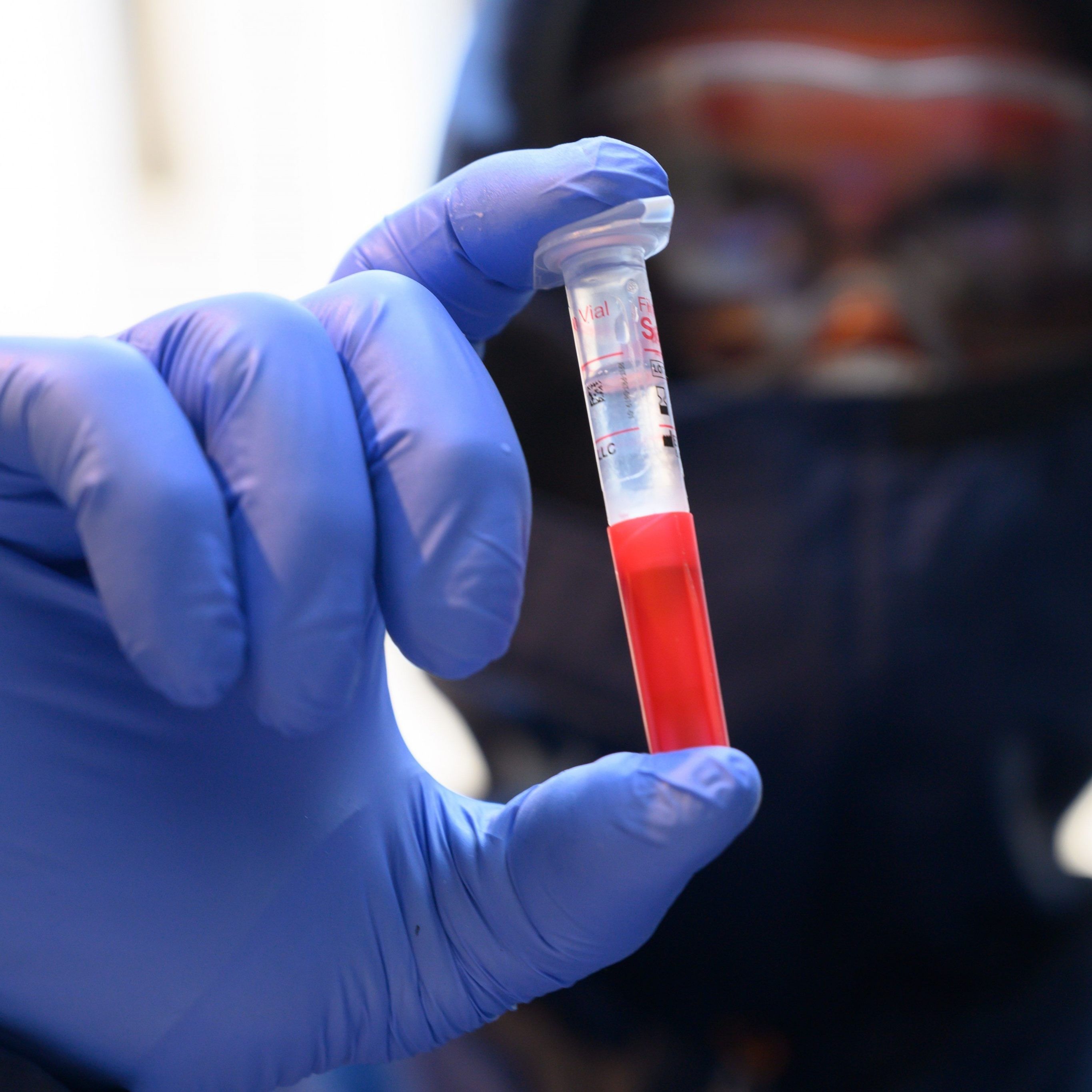 Was wir über das neuartige Virus wissen und was nicht.