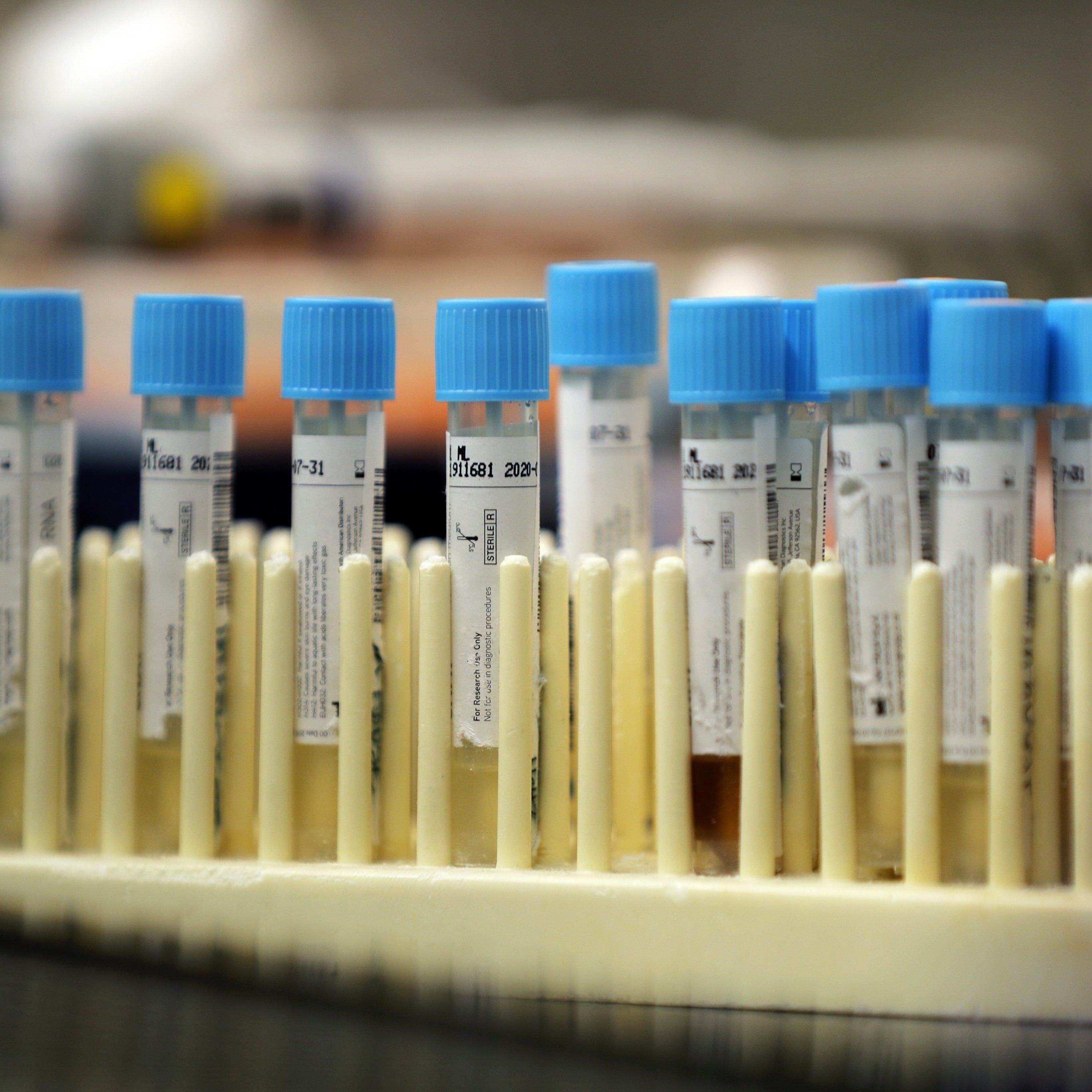 Bisher sind sechs Menschen an oder mit dem Virus in Vorarlberg gestorben.