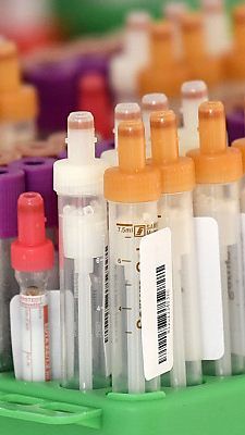 In 2.000 italienischen Gemeinden wird getestet