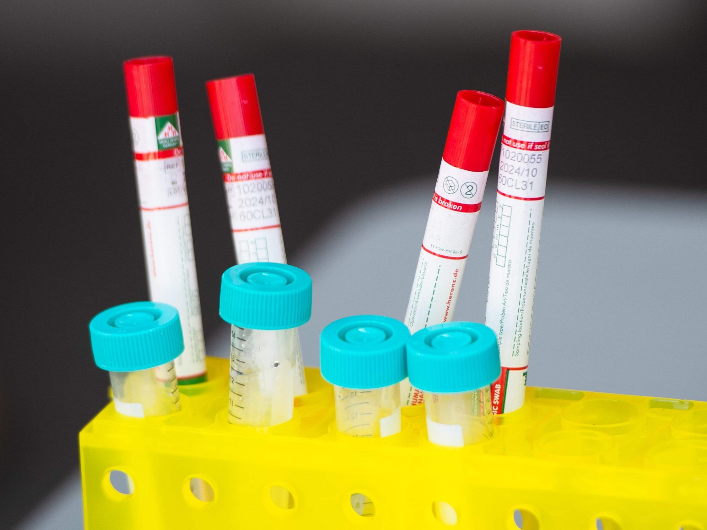 Knapp 2.900 Personen sind in Wien am Coronavirus erkrankt. Knapp 2.900 Personen sind in Wien am Coronavirus erkrankt.