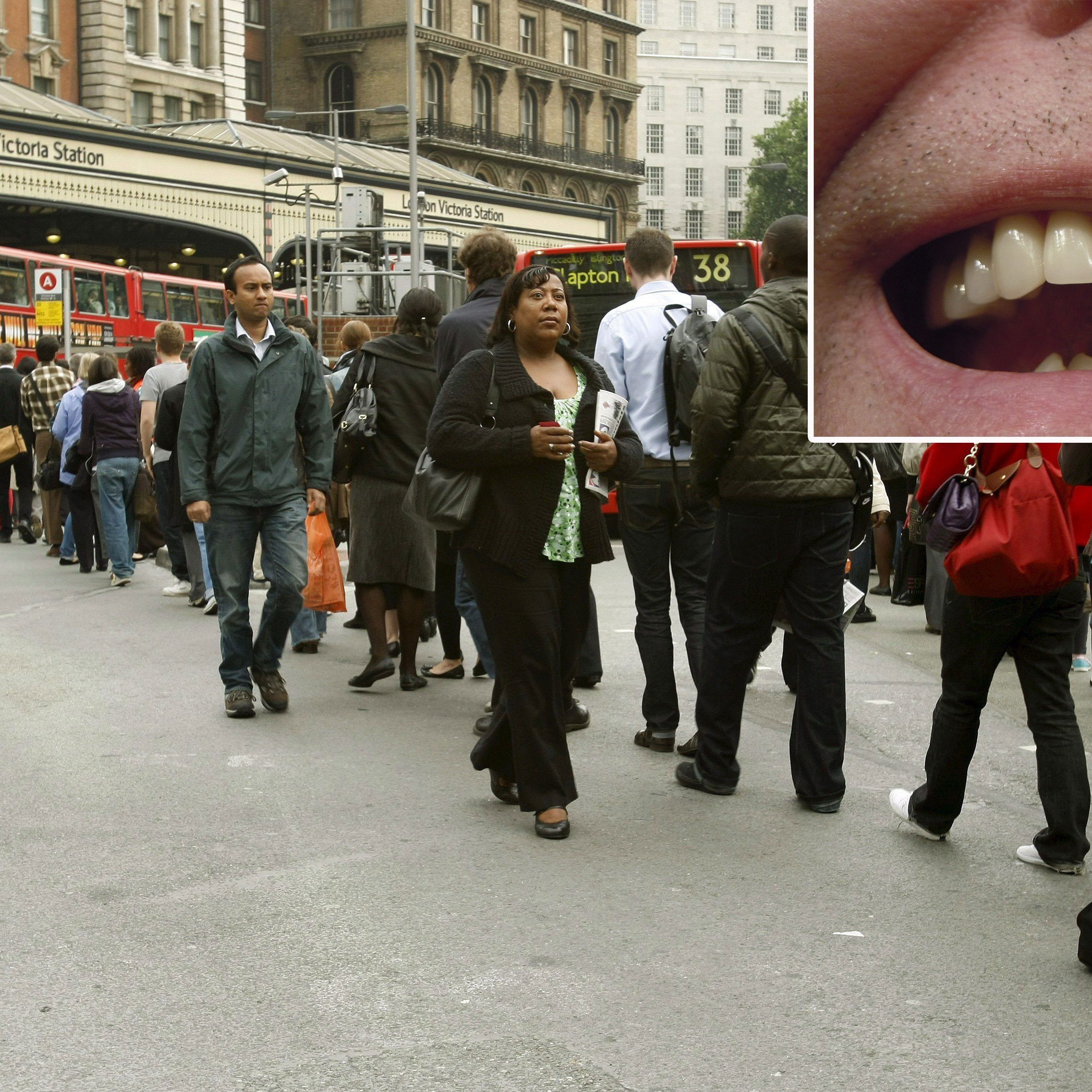 Hier geschah die Spuckattacke