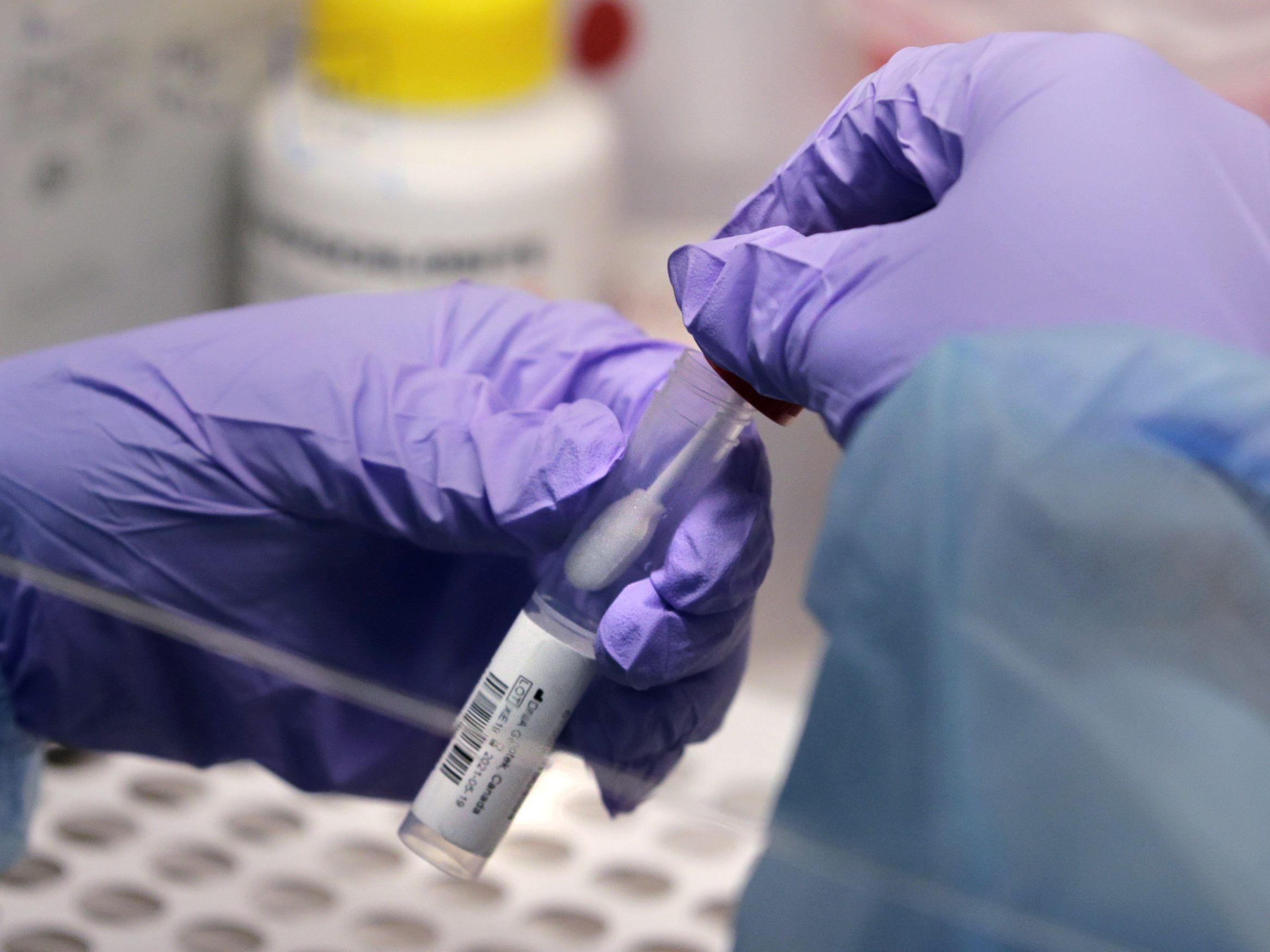 Russland mit Impfstoff gegen Corona-Virus. Russland mit Impfstoff gegen Corona-Virus.